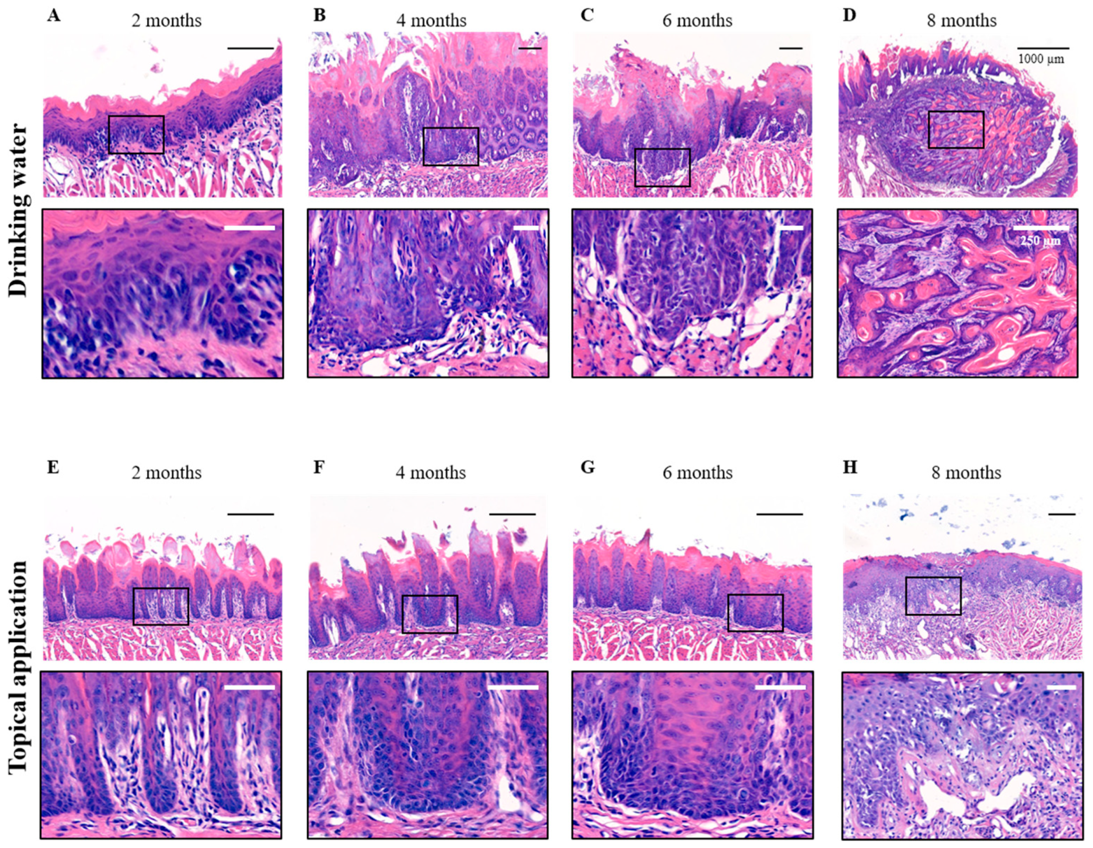 Cancers 17 02108 g002