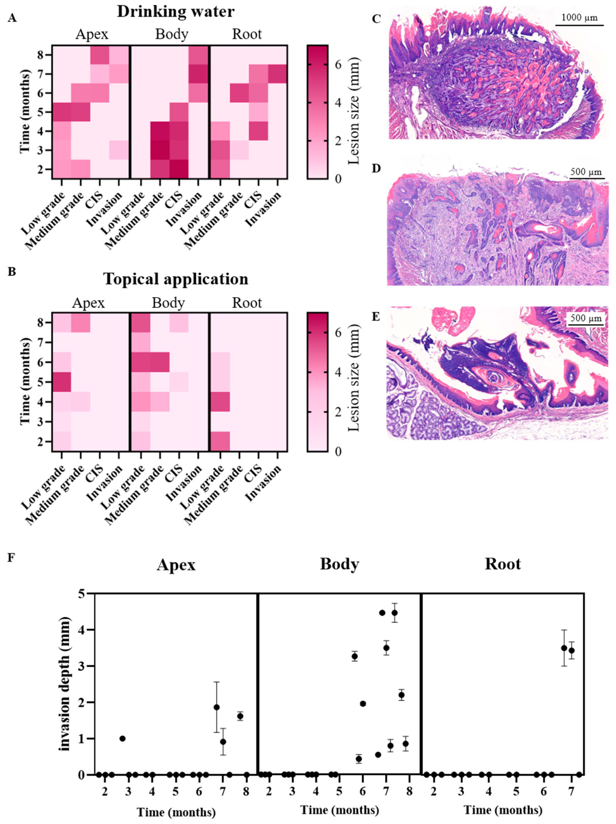 Cancers 17 02108 g003