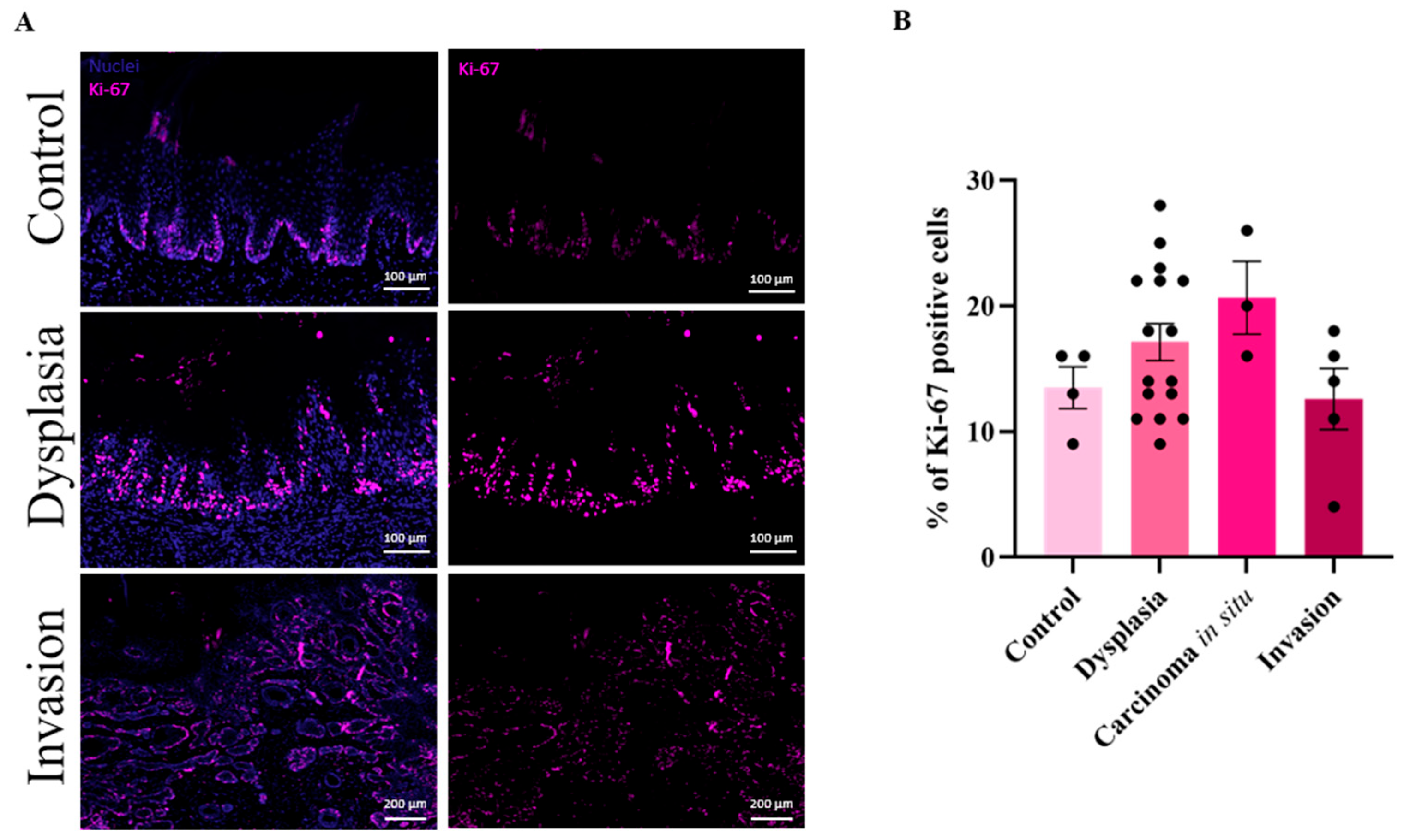 Cancers 17 02108 g004