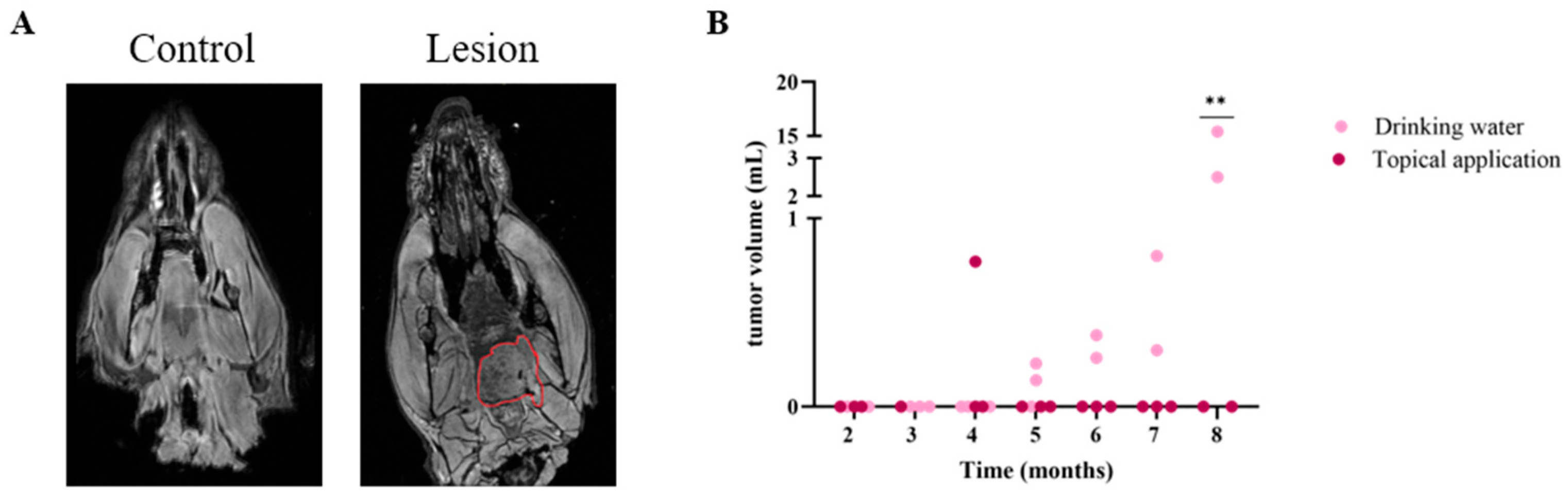 Cancers 17 02108 g005