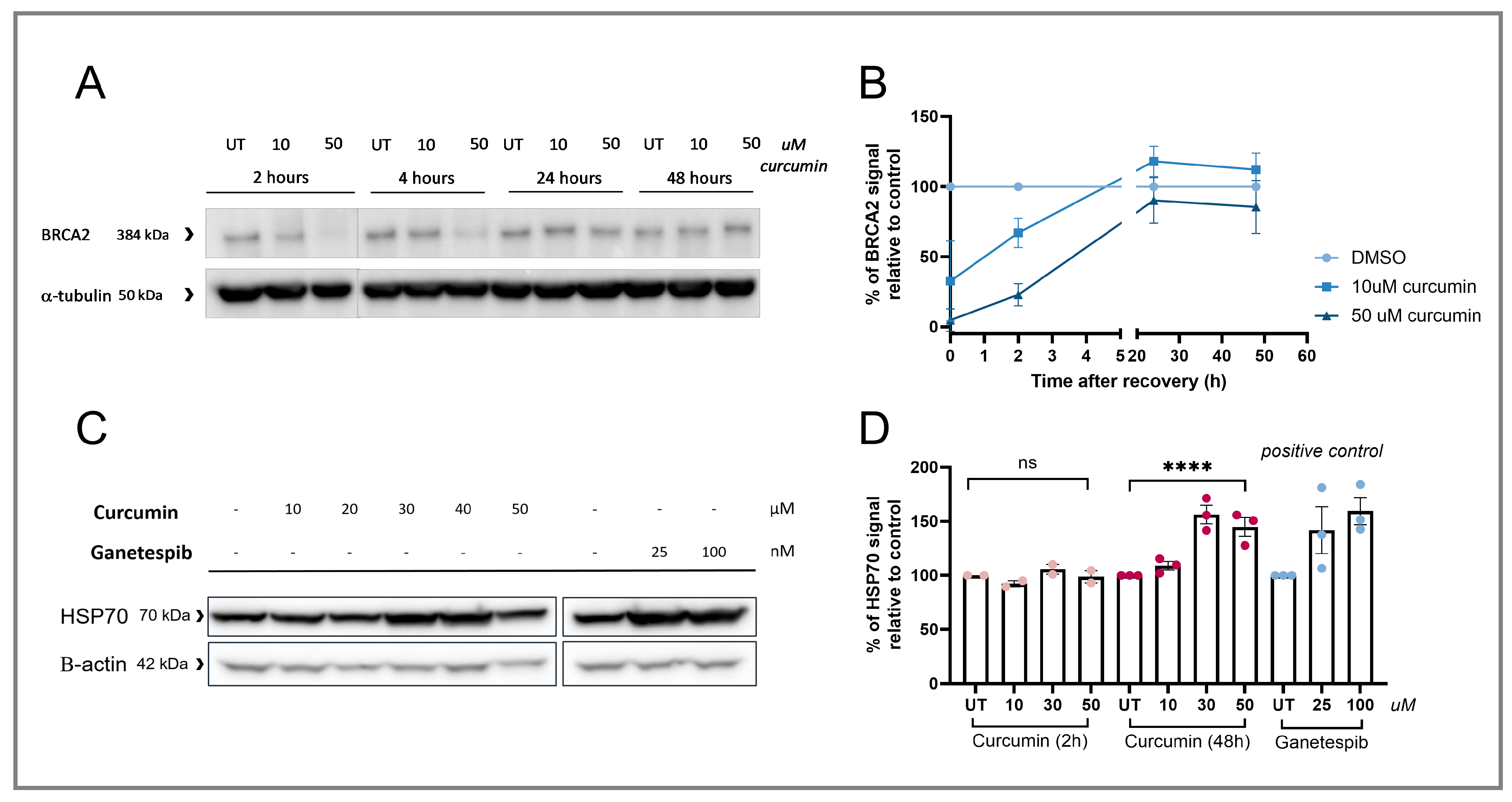 Cancers 17 02109 g004