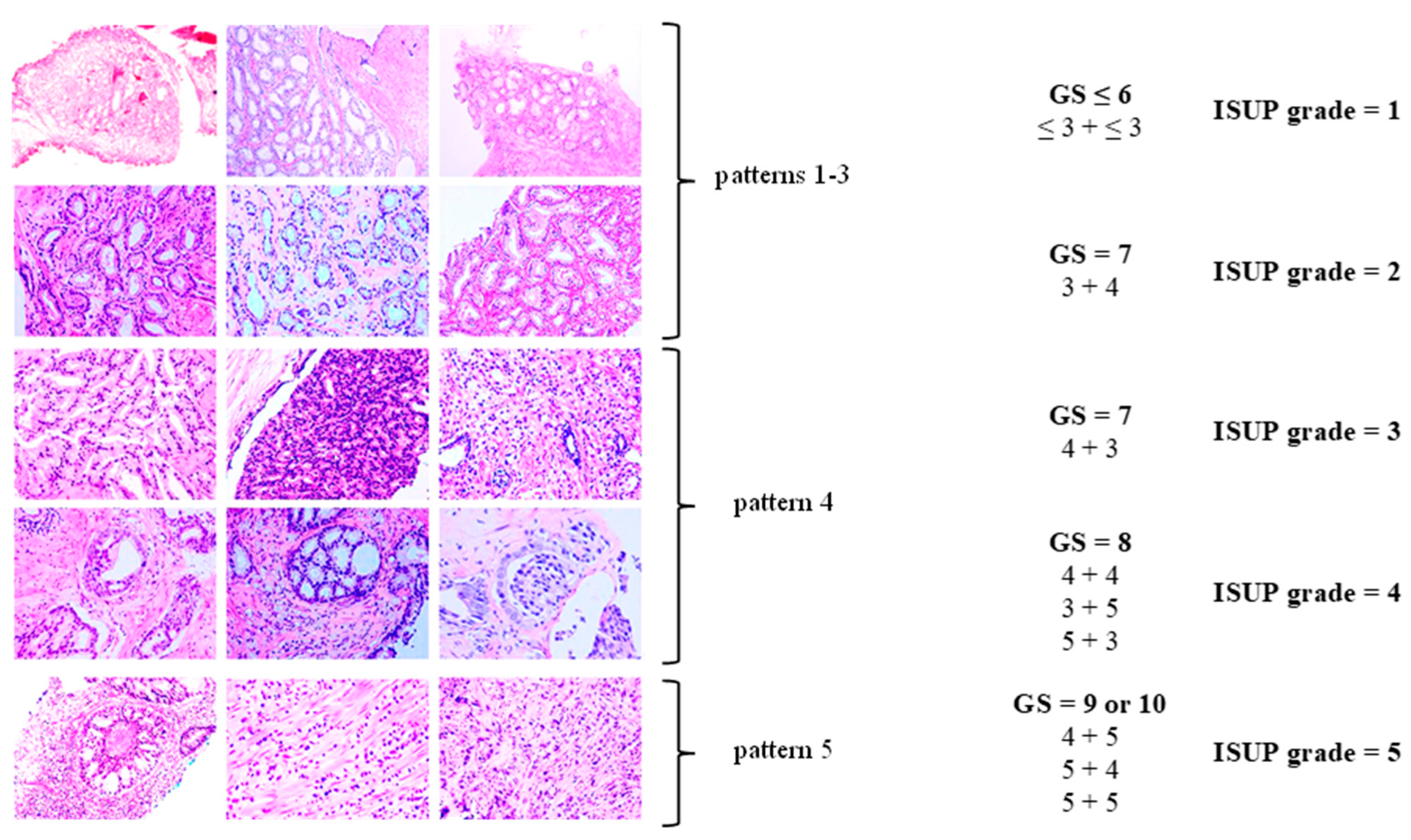 Cancers 17 02137 g002