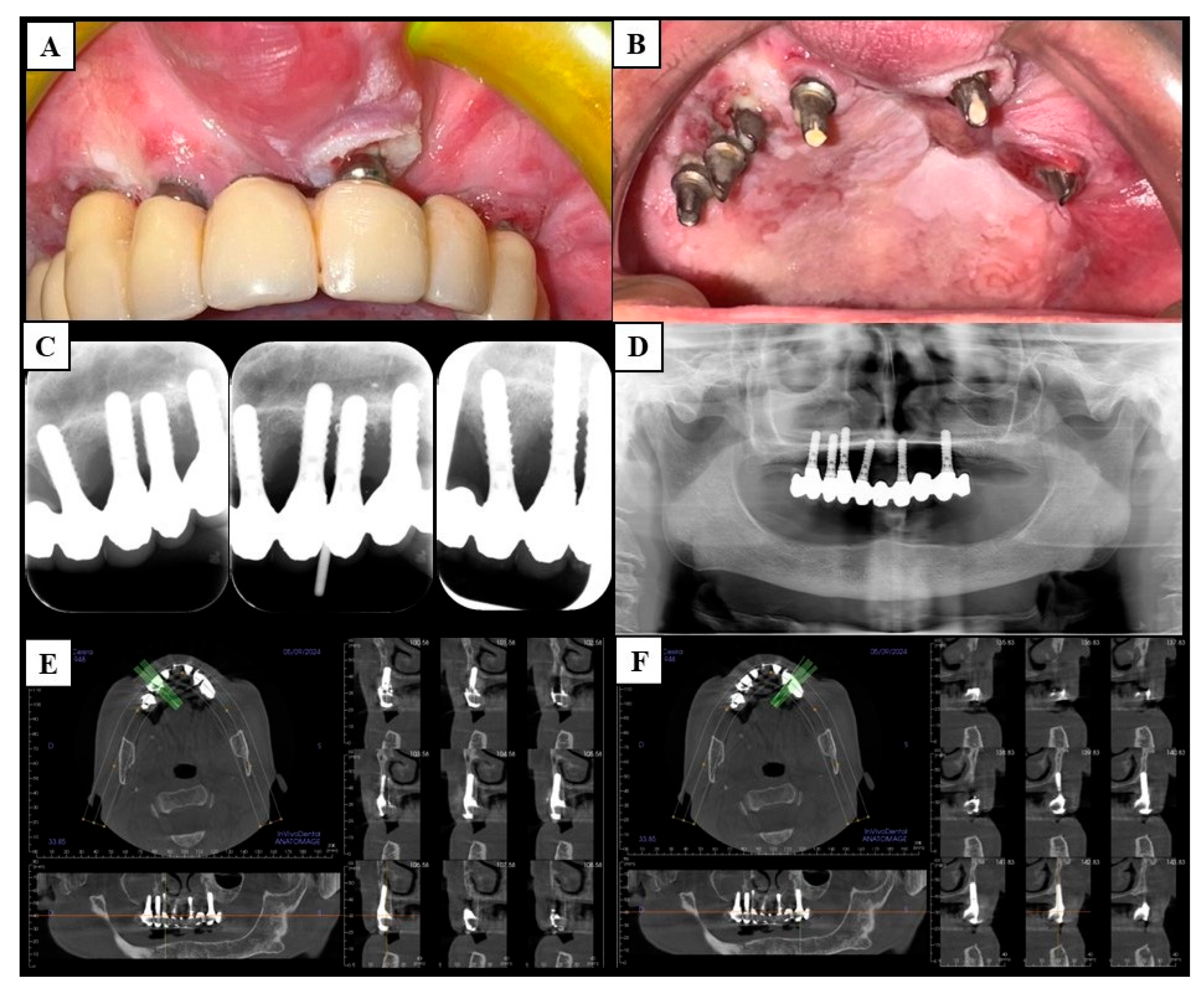 Cancers 17 02149 g001 Cancers 17 02149 g001