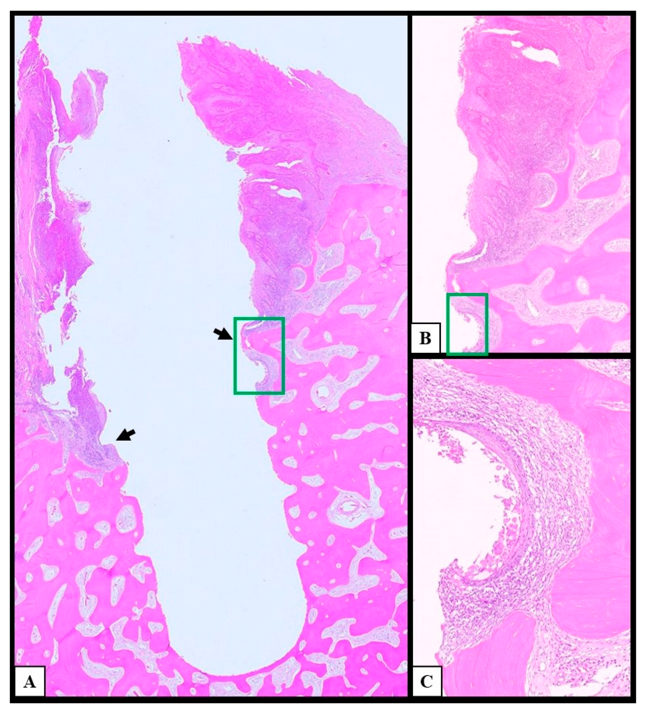 Cancers 17 02149 g003 Cancers 17 02149 g003
