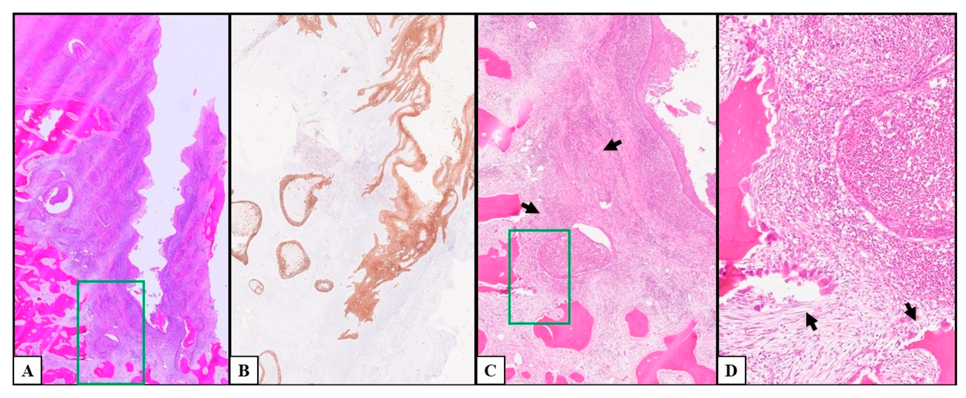 Cancers 17 02149 g004 Cancers 17 02149 g004