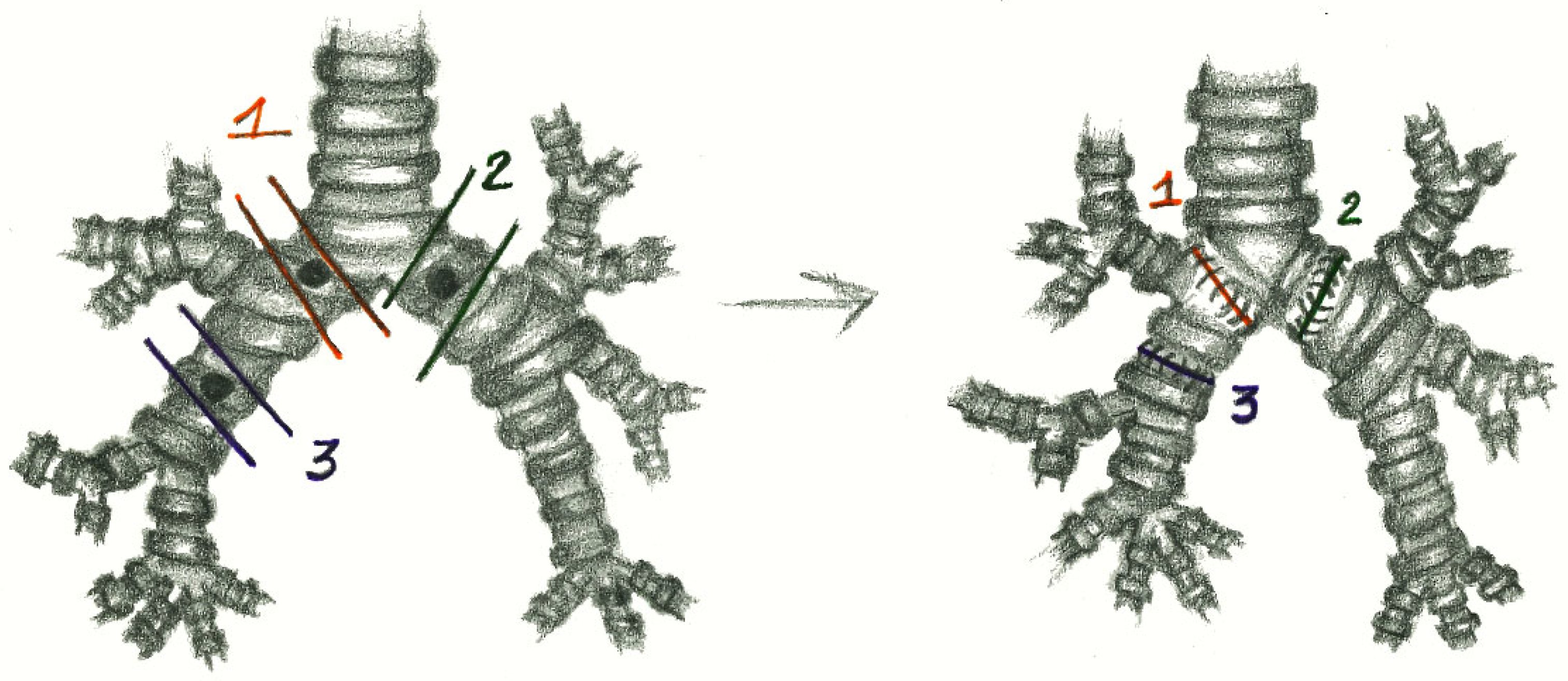 Cancers 17 02156 g001