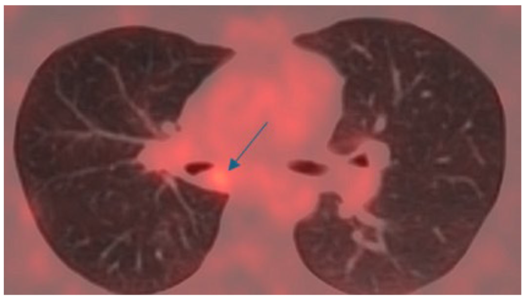 Cancers 17 02156 g011