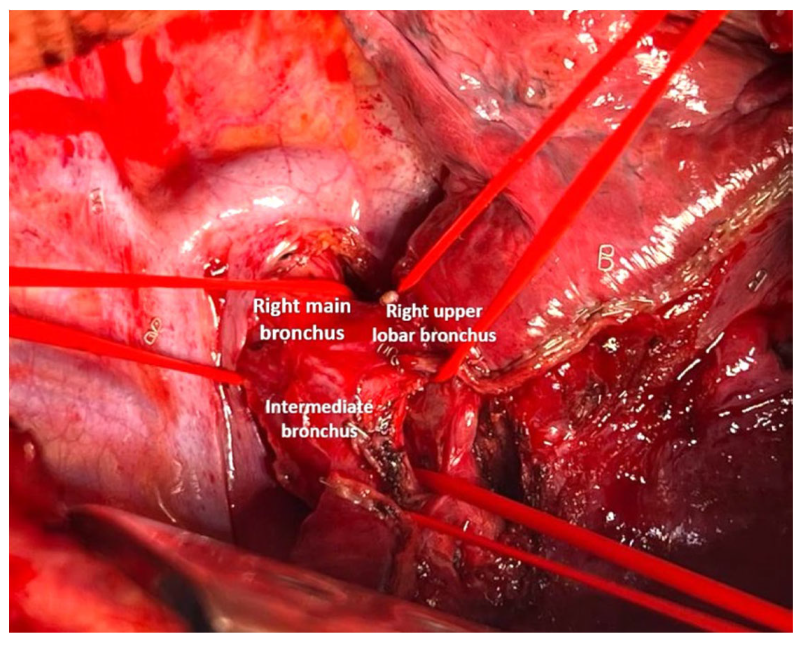 Cancers 17 02156 g012