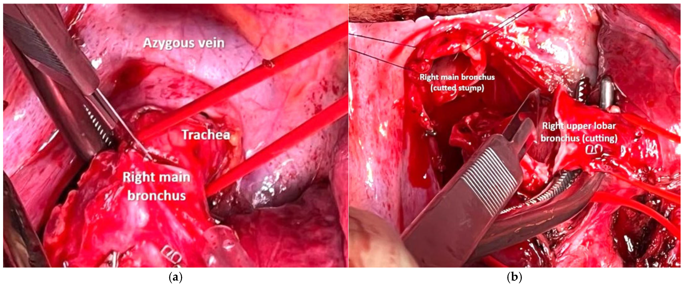 Cancers 17 02156 g013