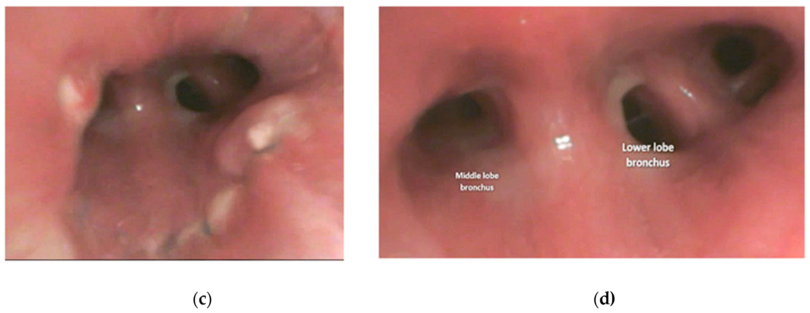 Cancers 17 02156 g016b