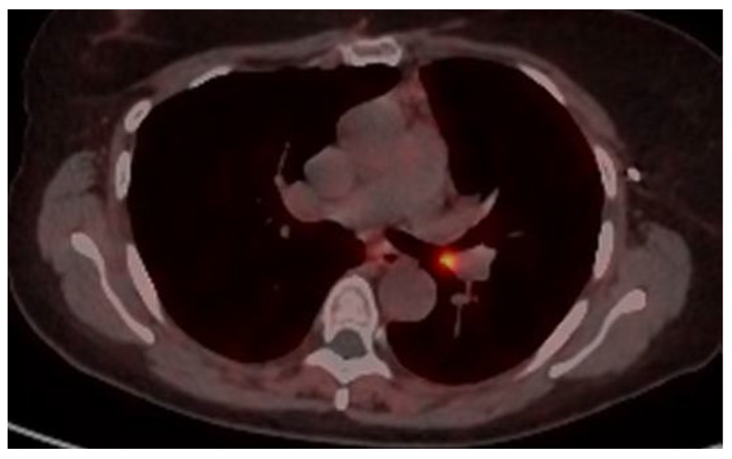 Cancers 17 02156 g018