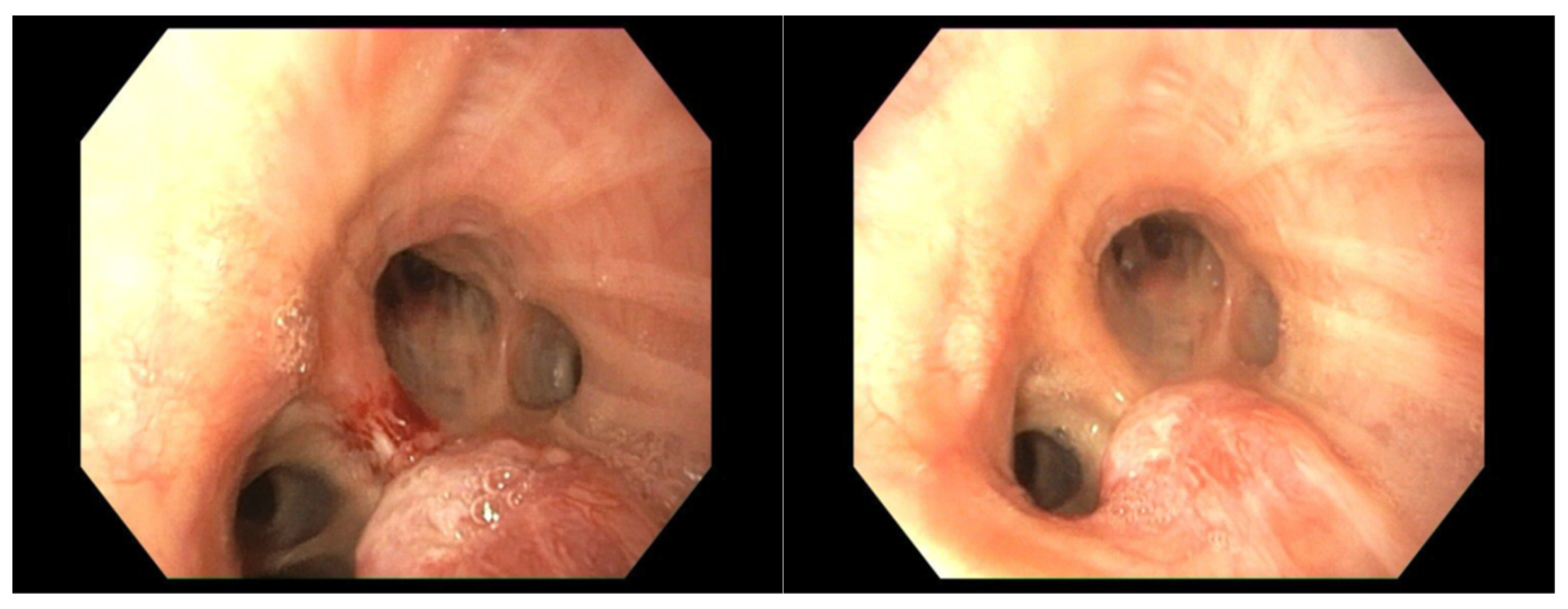 Cancers 17 02156 g019