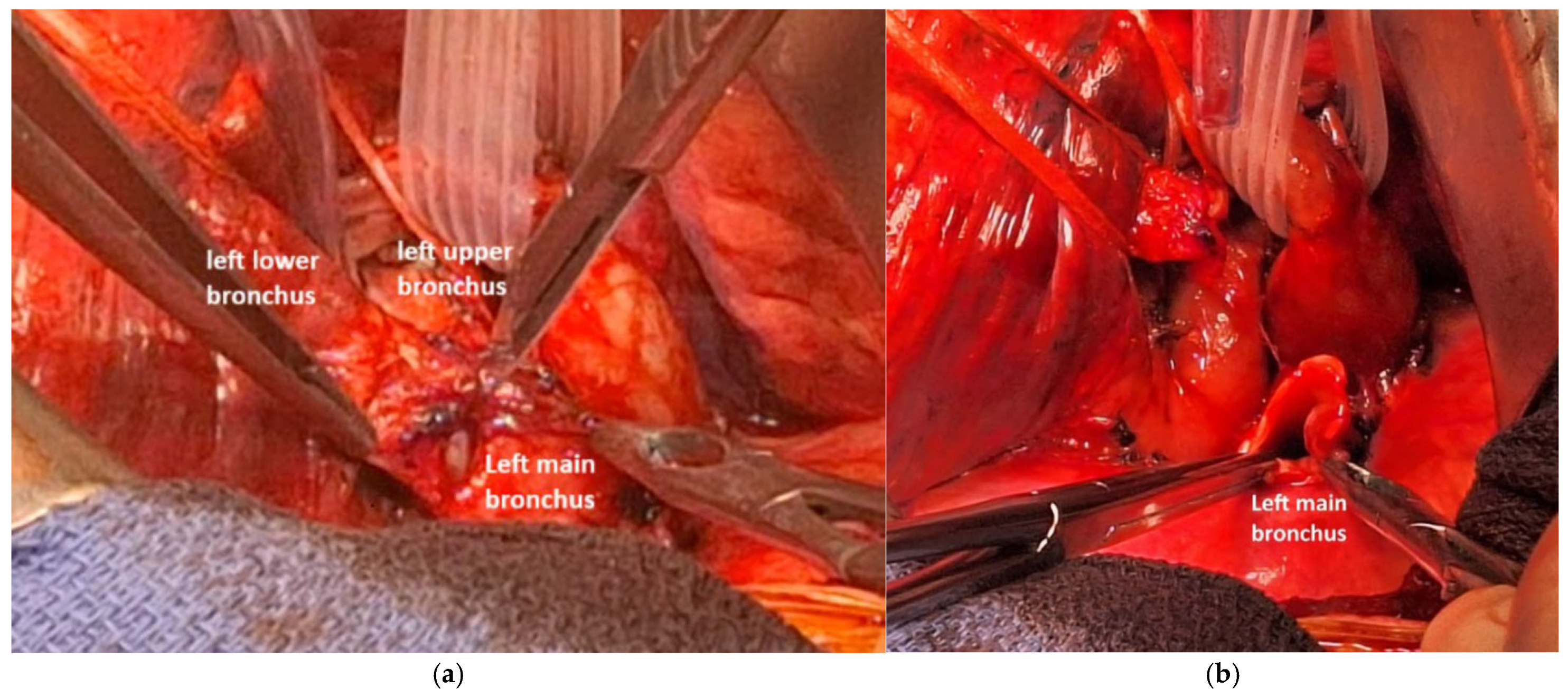 Cancers 17 02156 g021