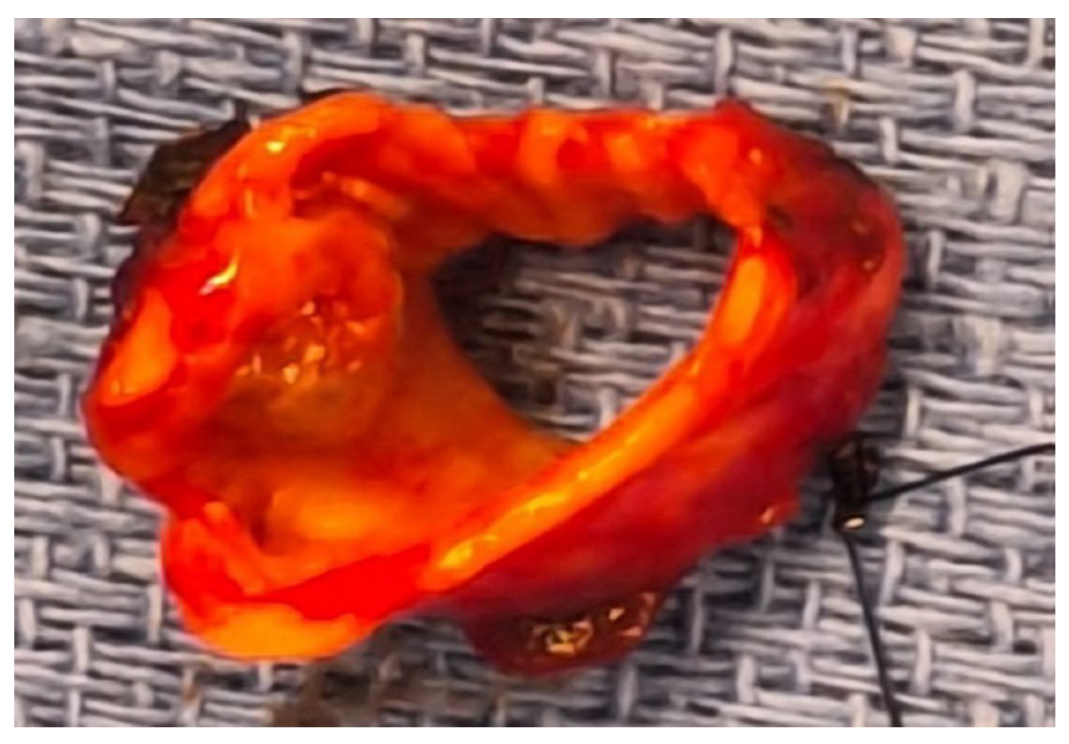 Cancers 17 02156 g022