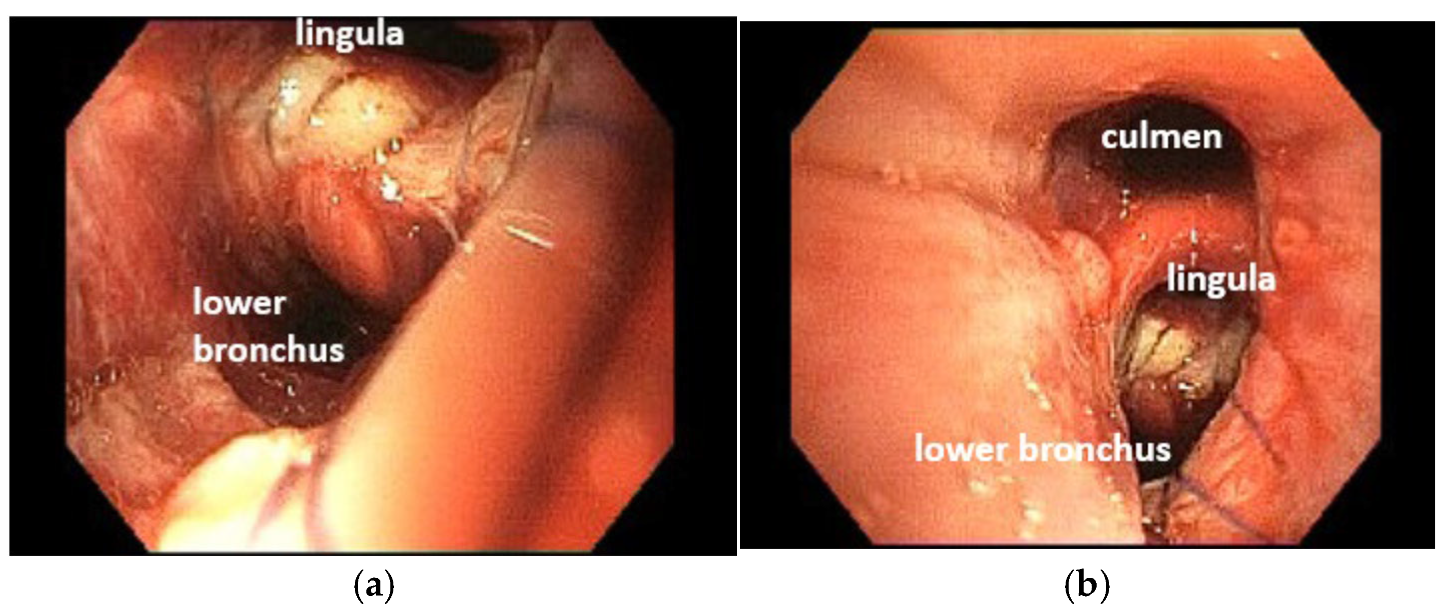 Cancers 17 02156 g024