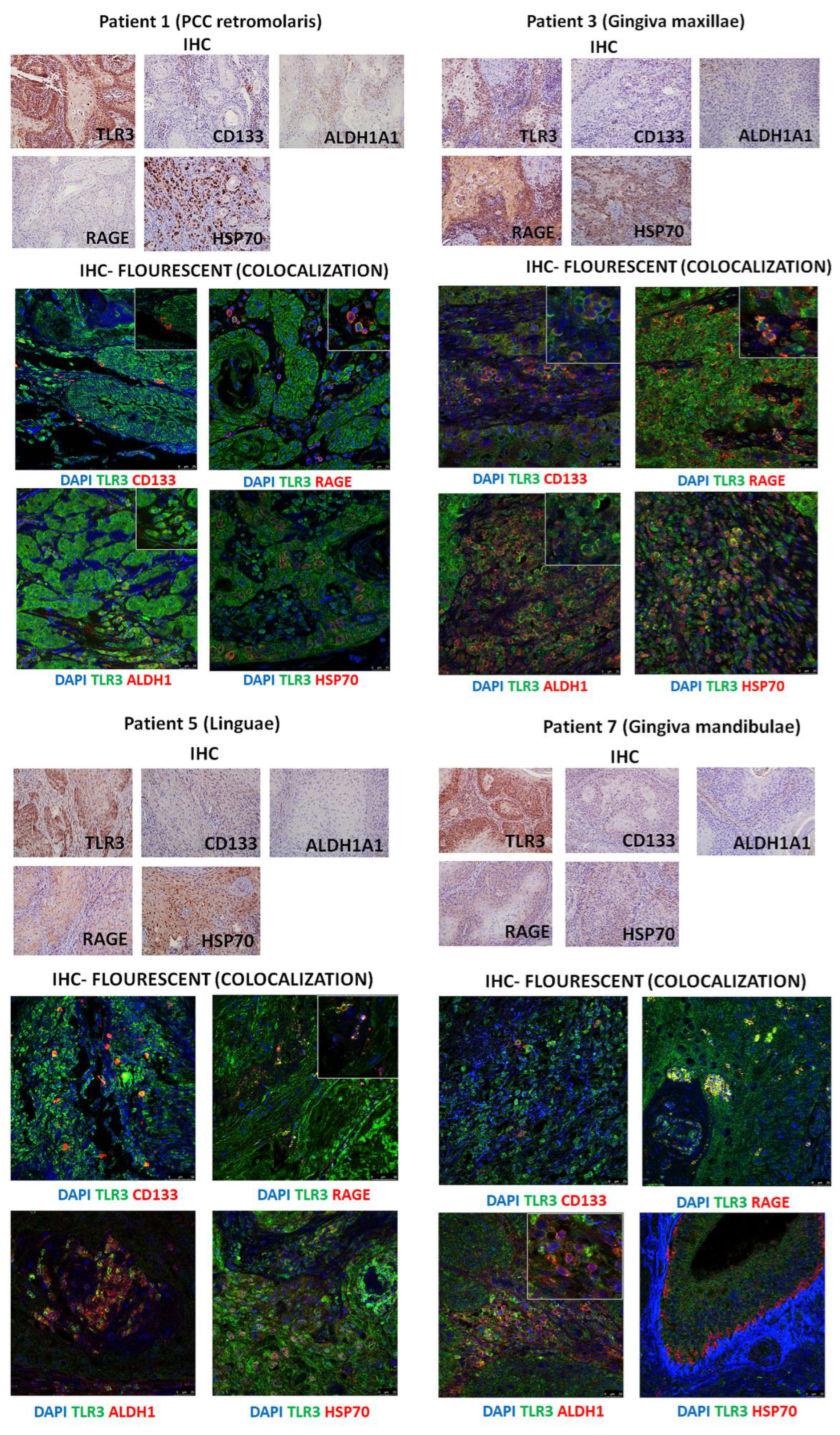 Cancers 17 02157 g004 Cancers 17 02157 g004