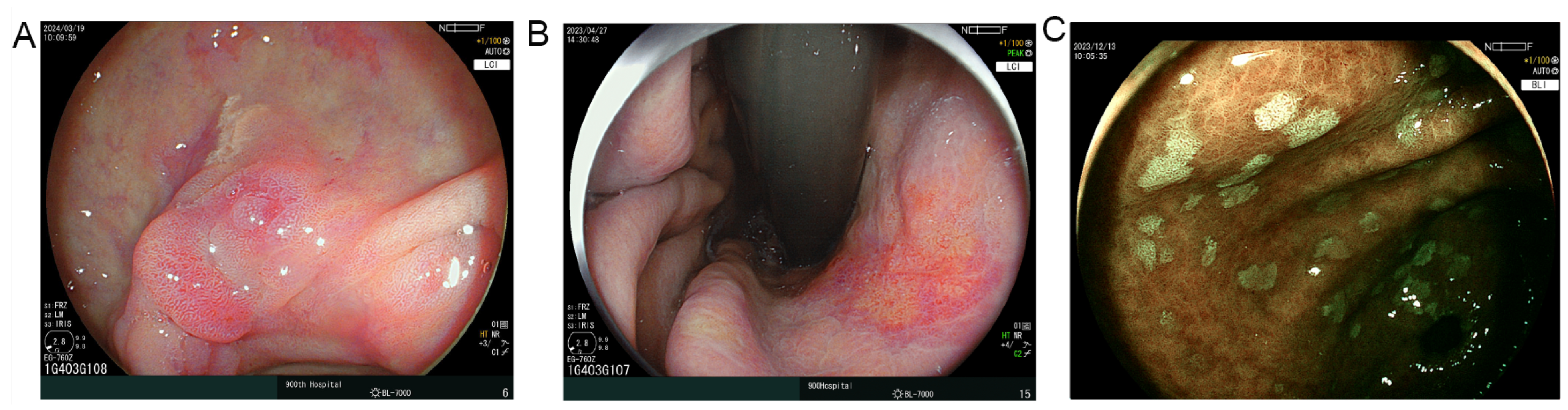 Cancers 17 02158 g004