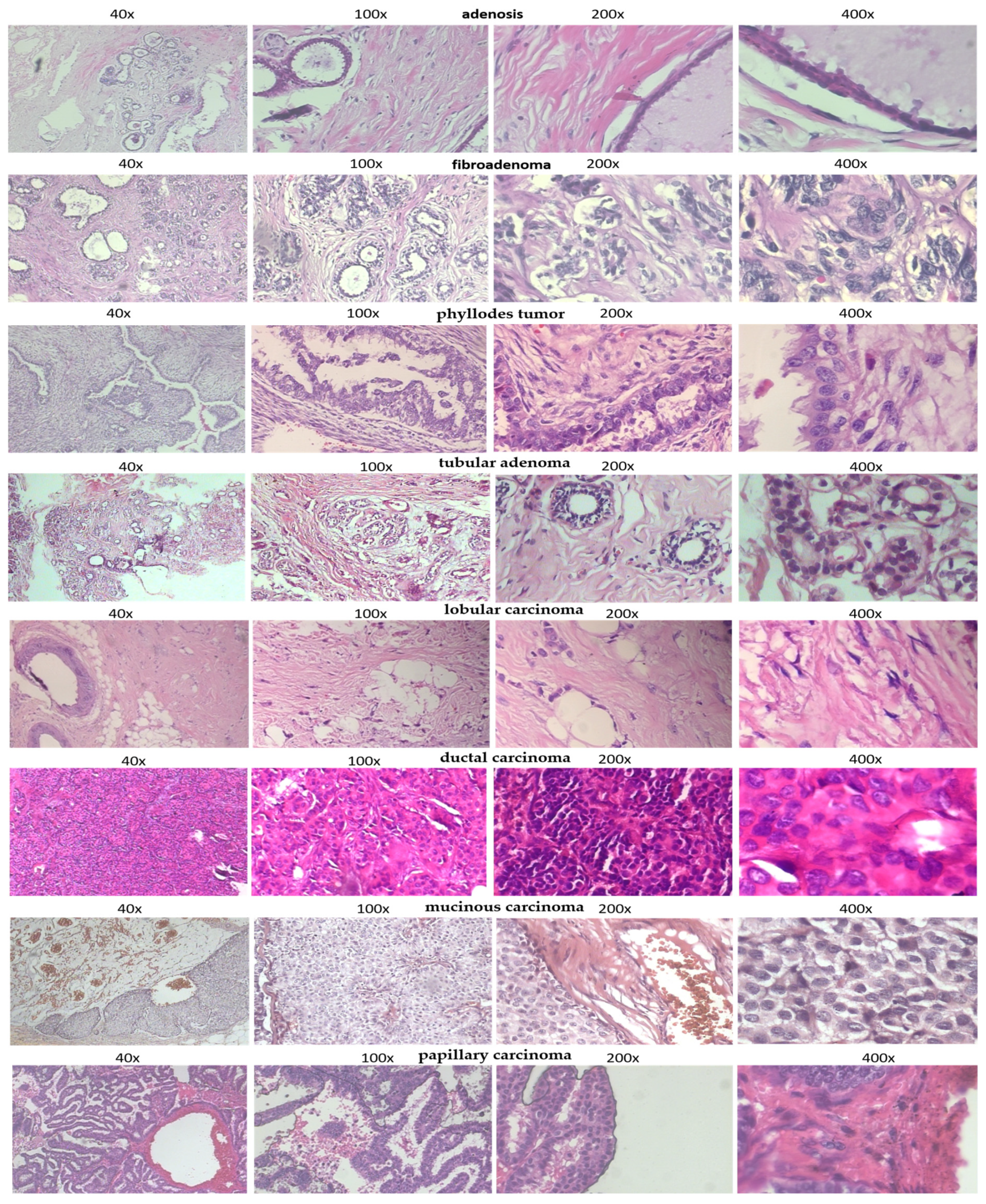 Cancers 17 02159 g002