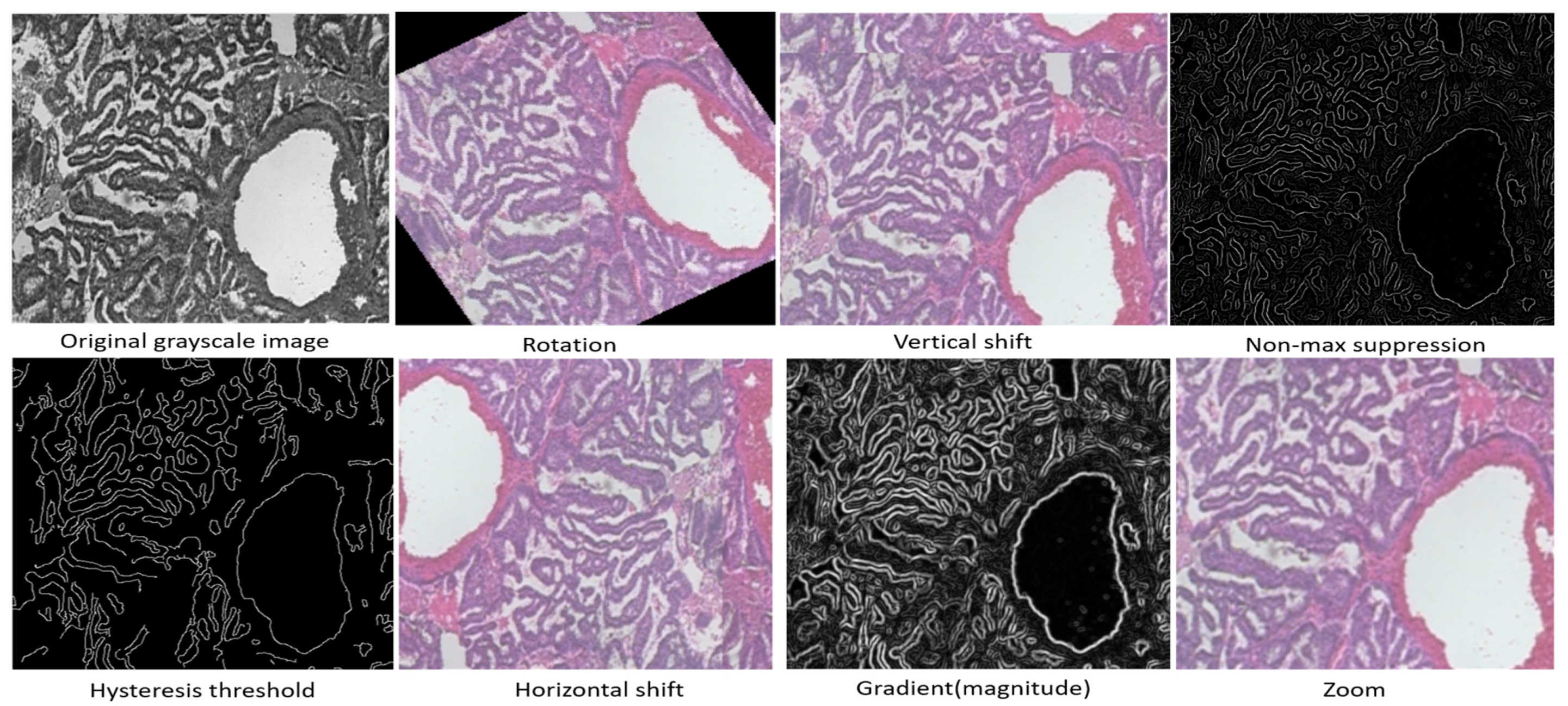 Cancers 17 02159 g003