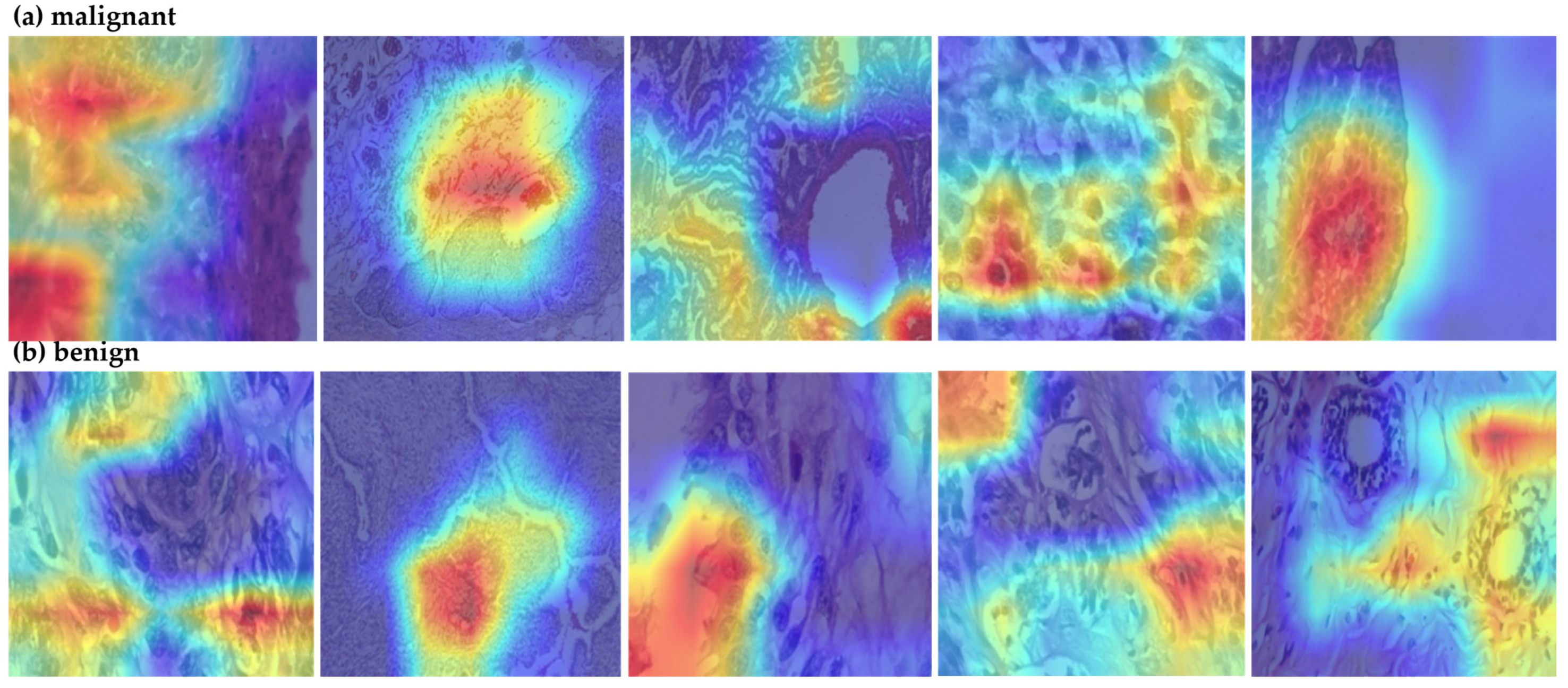 Cancers 17 02159 g004