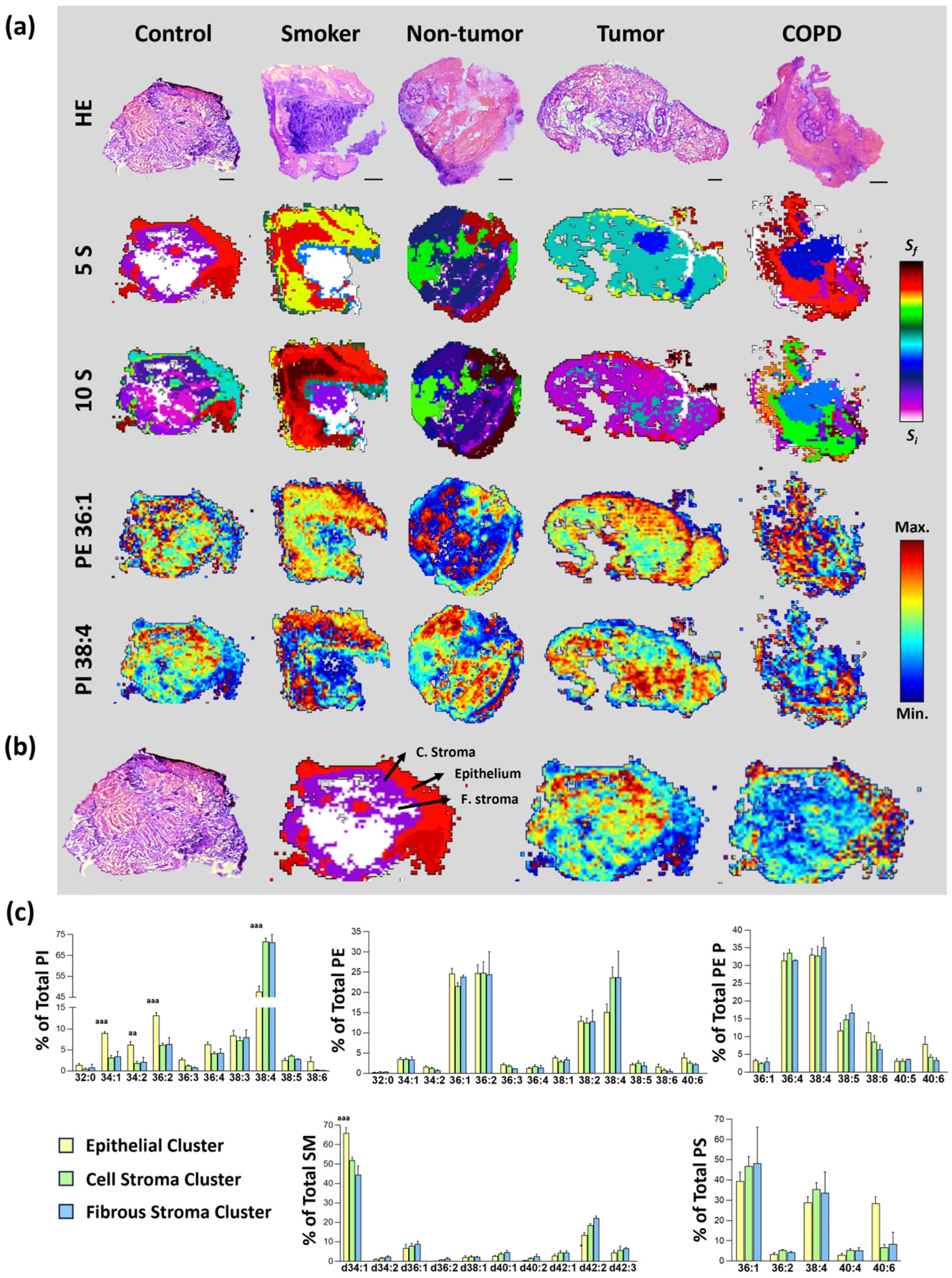 Cancers 17 02160 g002