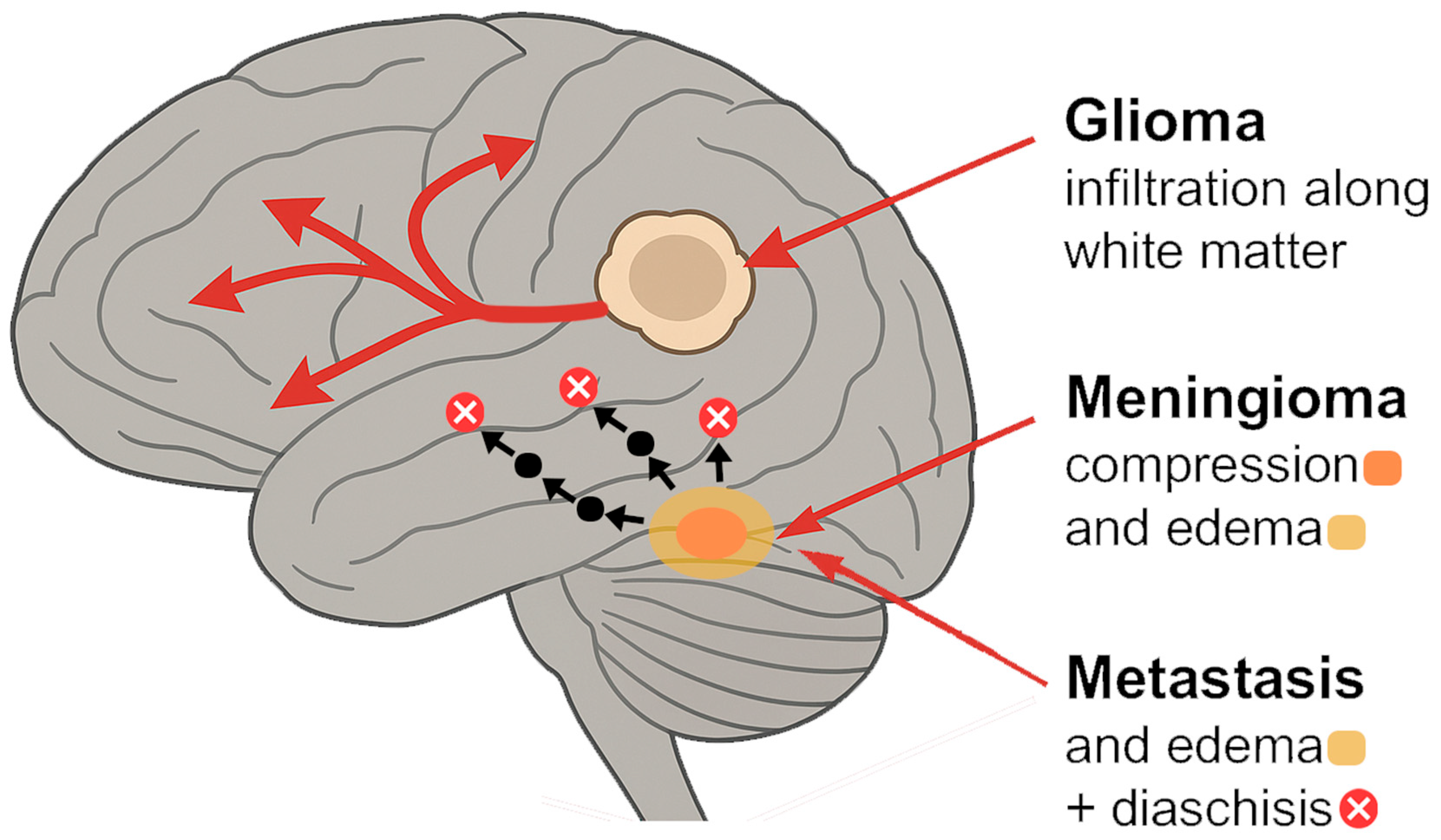 Cancers 17 02174 g001