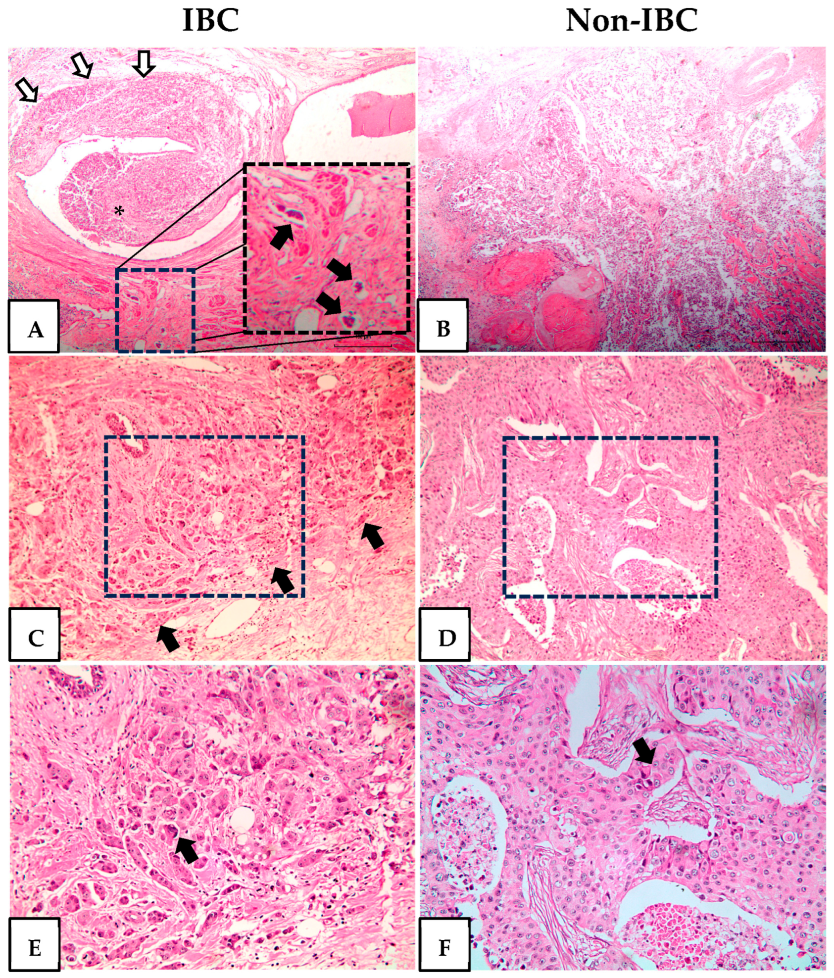 Cancers 17 02182 g001 Cancers 17 02182 g001