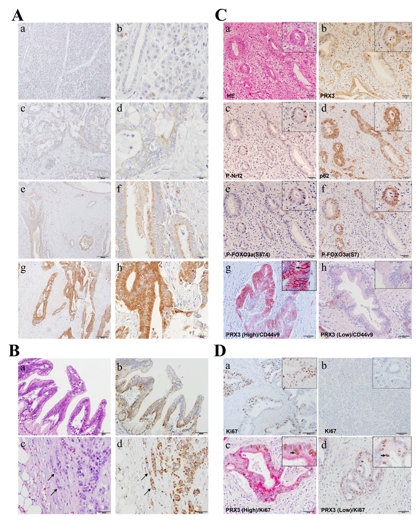 Cancers 17 02212 g002