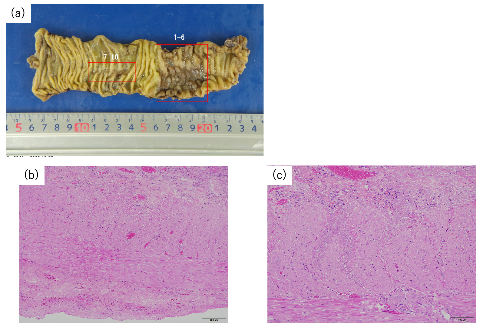 Cancers 17 02230 g003