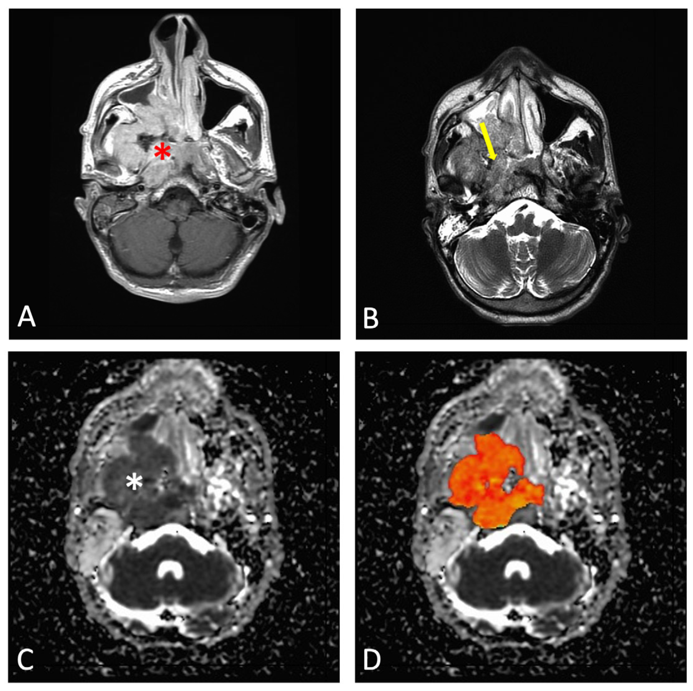 Cancers 17 02237 g002