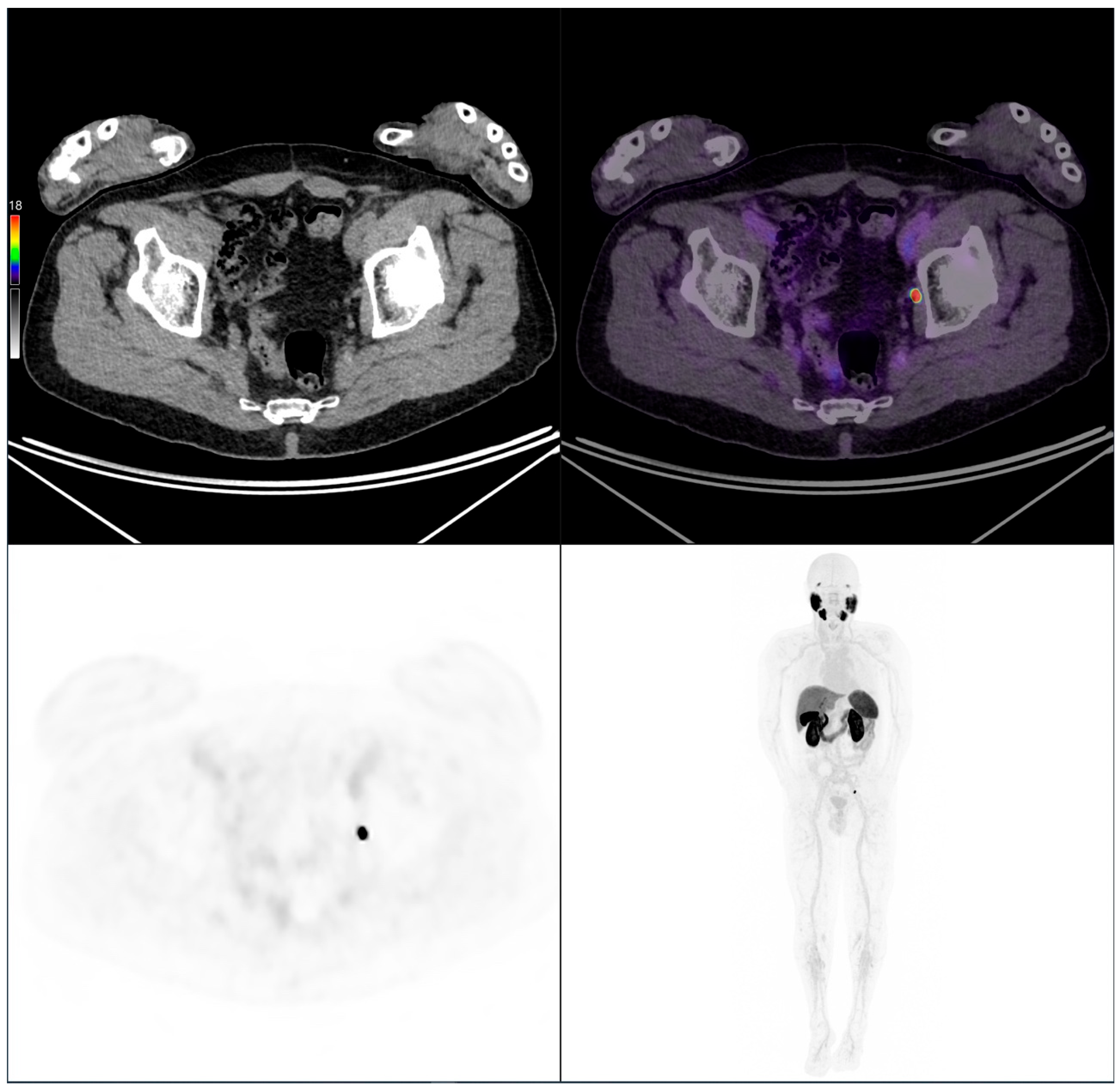 Cancers 17 02249 g007