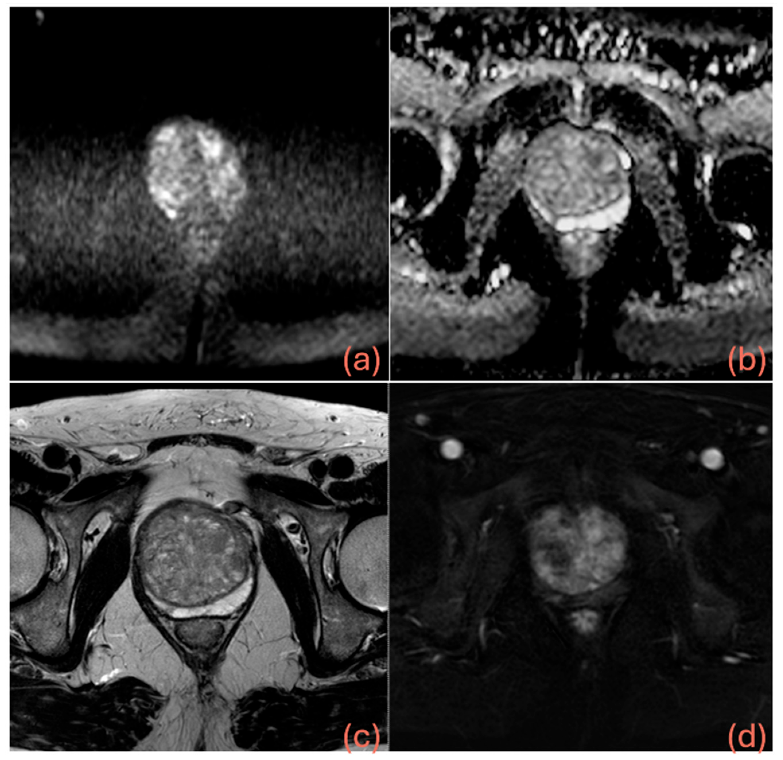 Cancers 17 02257 g005