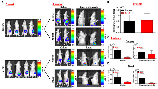 Establishment of an Orthotopic and Metastatic Colorectal Cancer Mouse ...