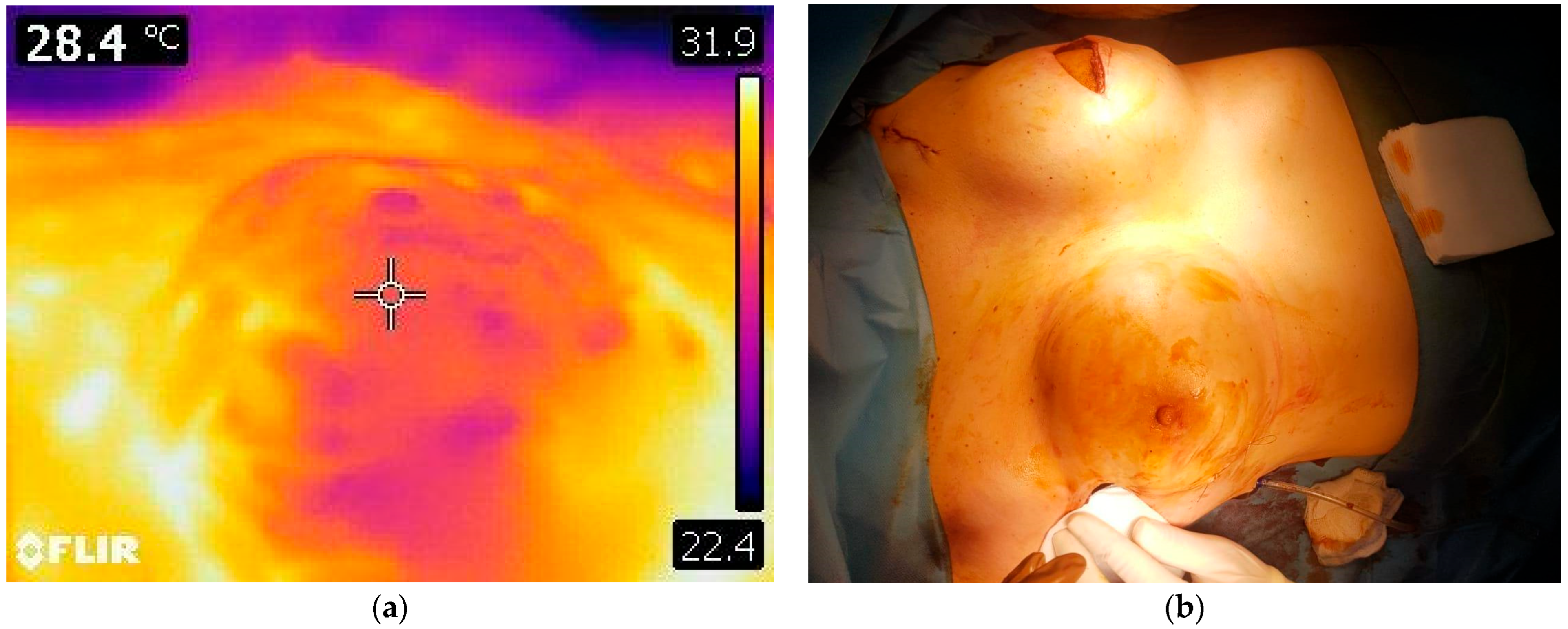 Cancers 17 02267 g003