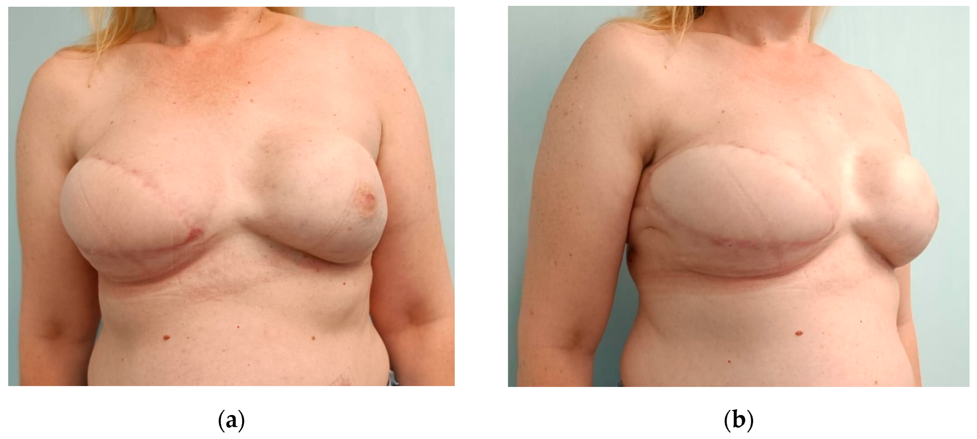 Cancers 17 02267 g007