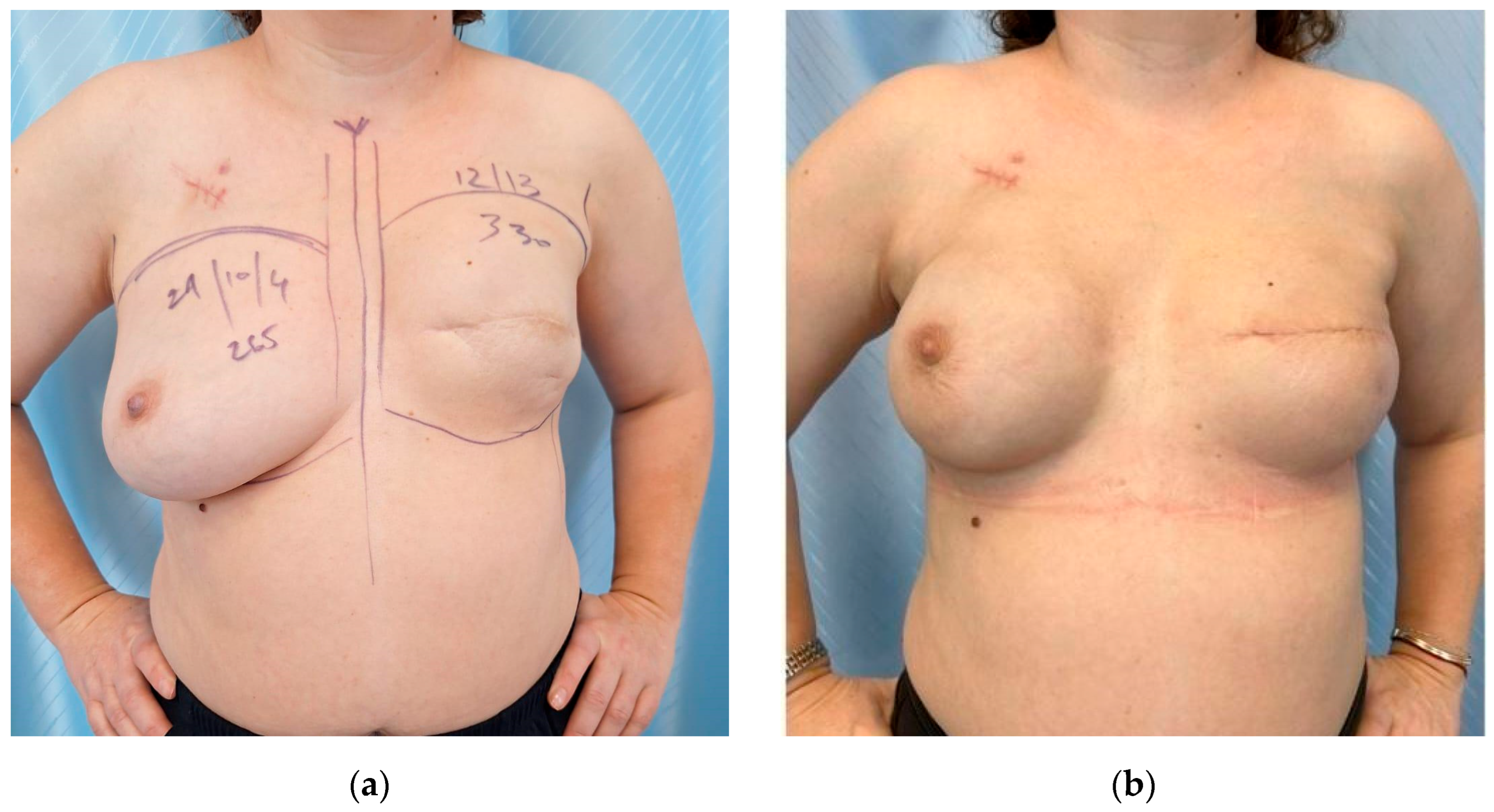 Cancers 17 02267 g008