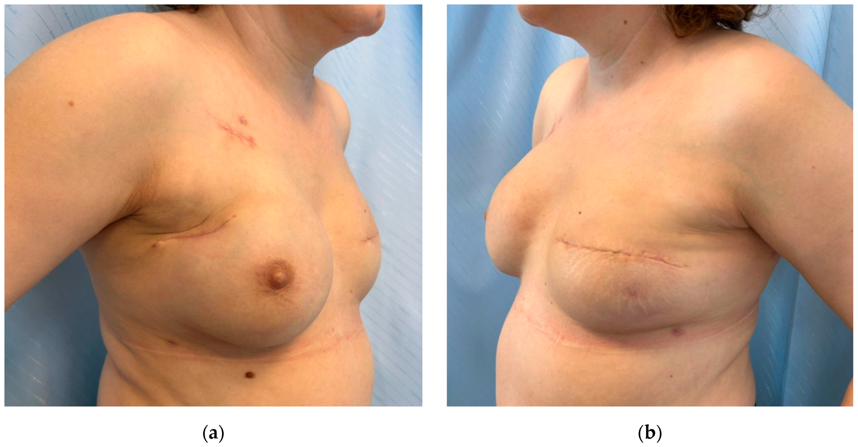 Cancers 17 02267 g009