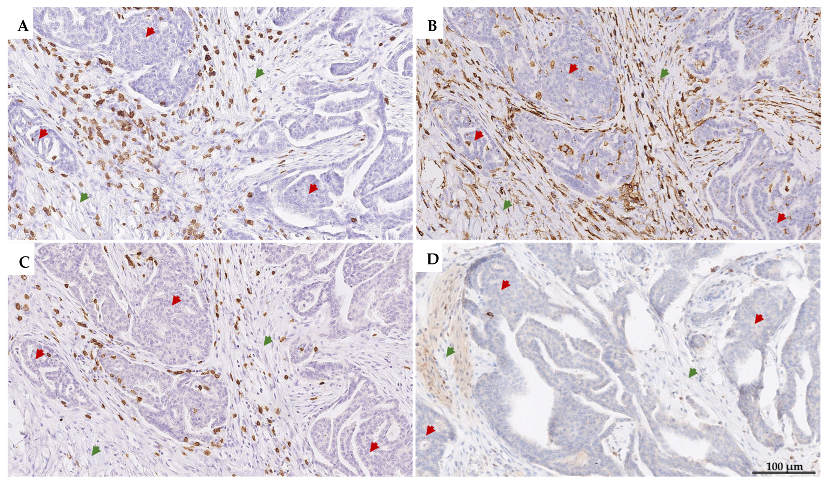 Cancers 17 02269 g003