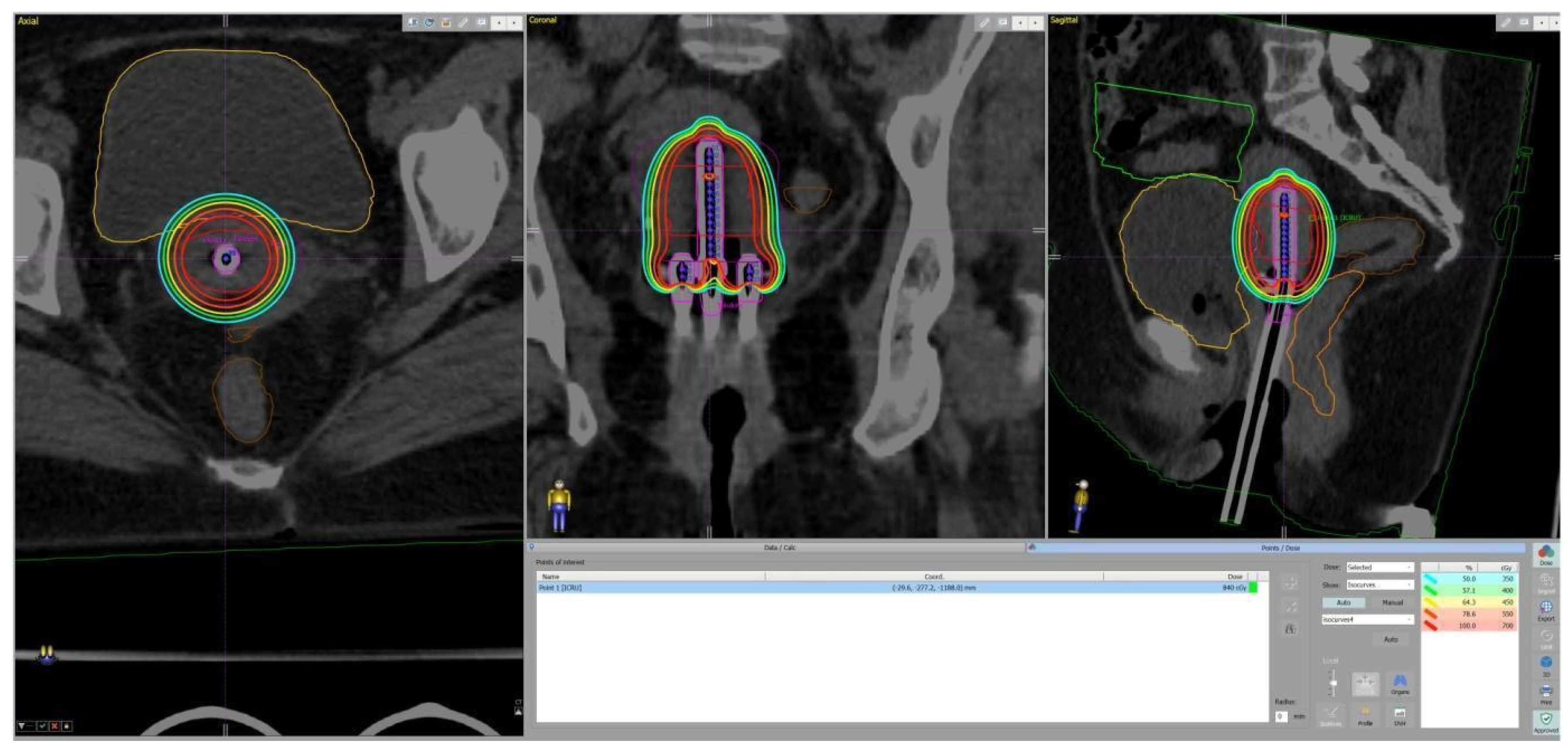 Cancers 17 02286 g002