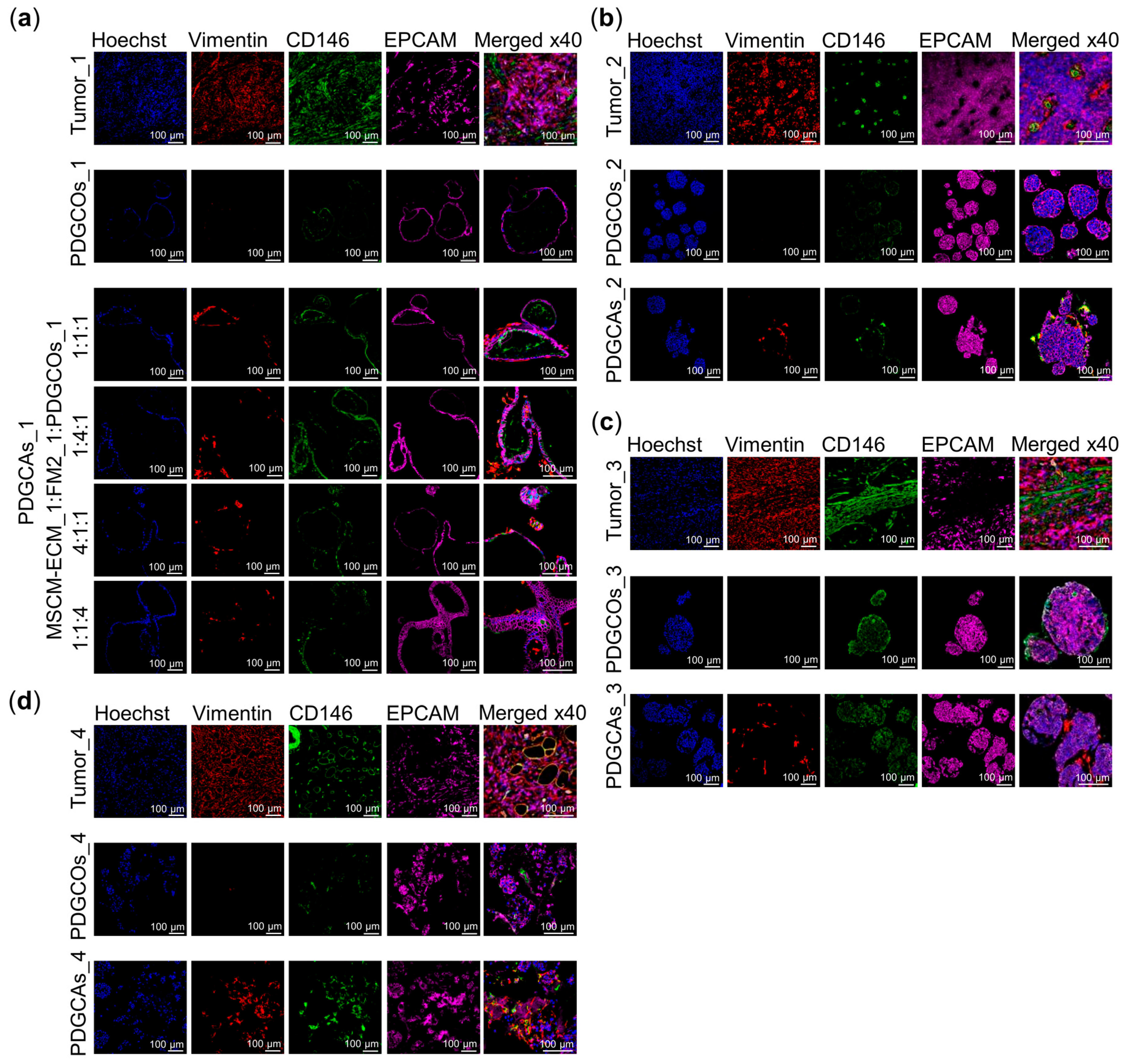 Cancers 17 02287 g005