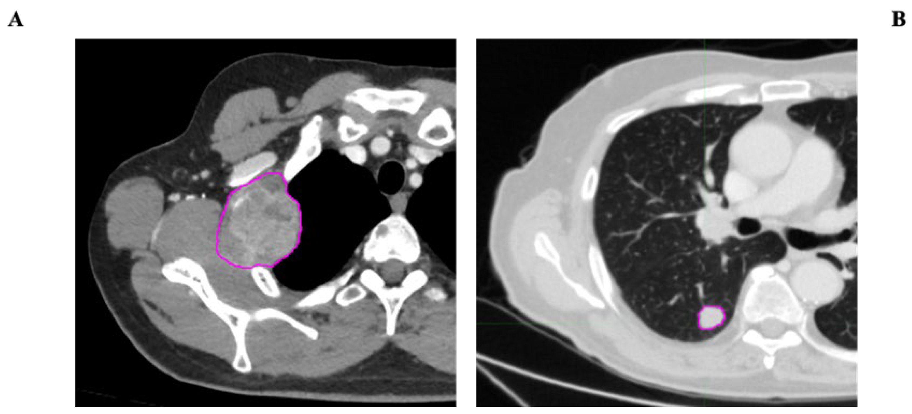 Cancers 17 02304 g002