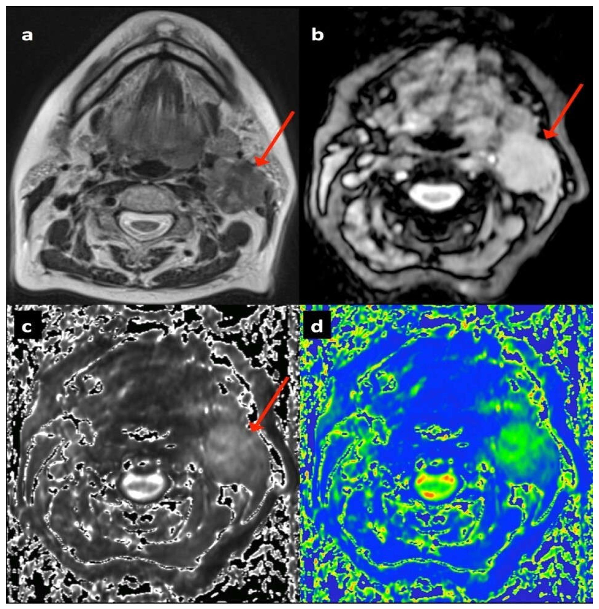 Cancers 17 02333 g001