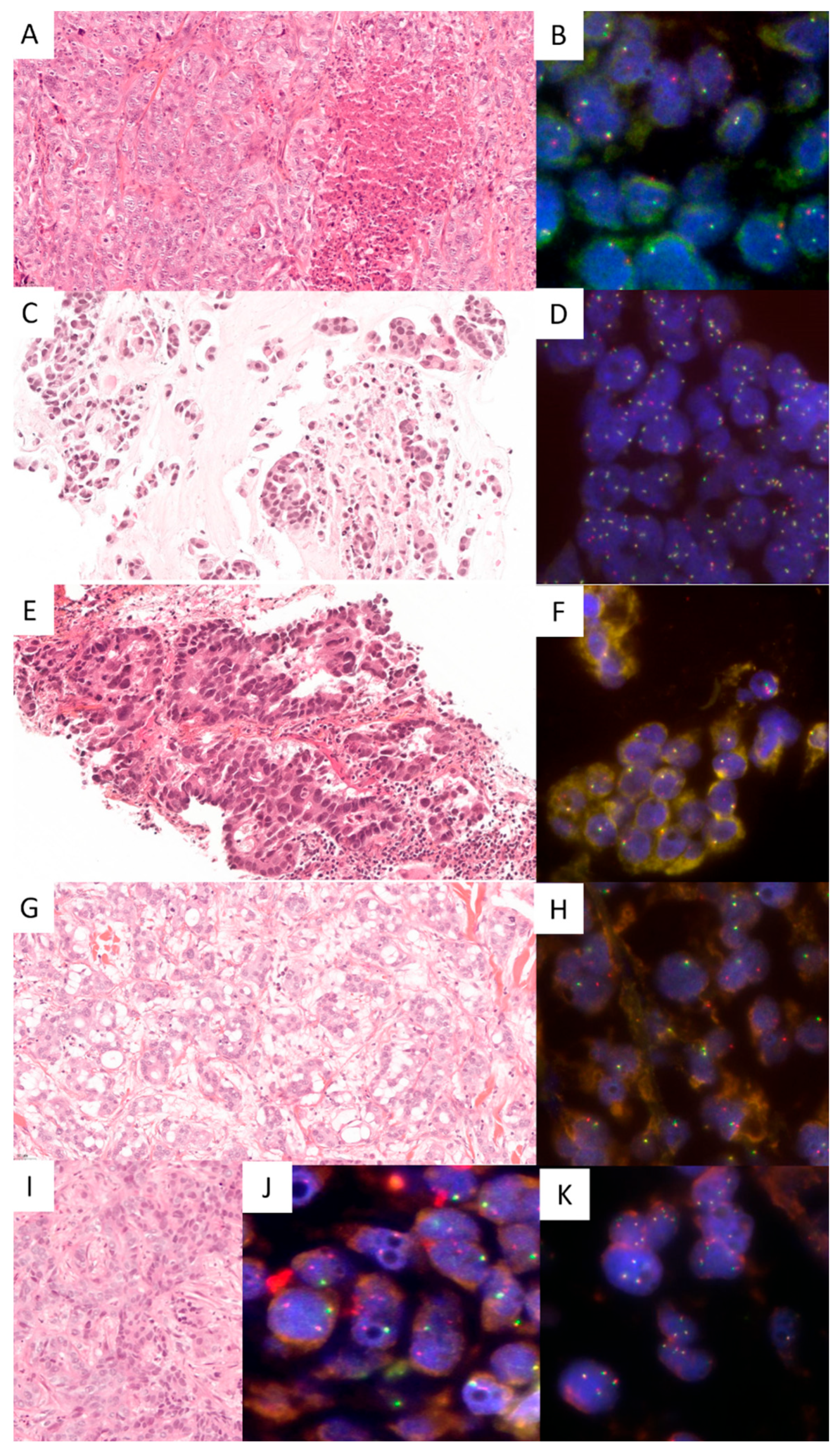 Cancers 17 02347 g001