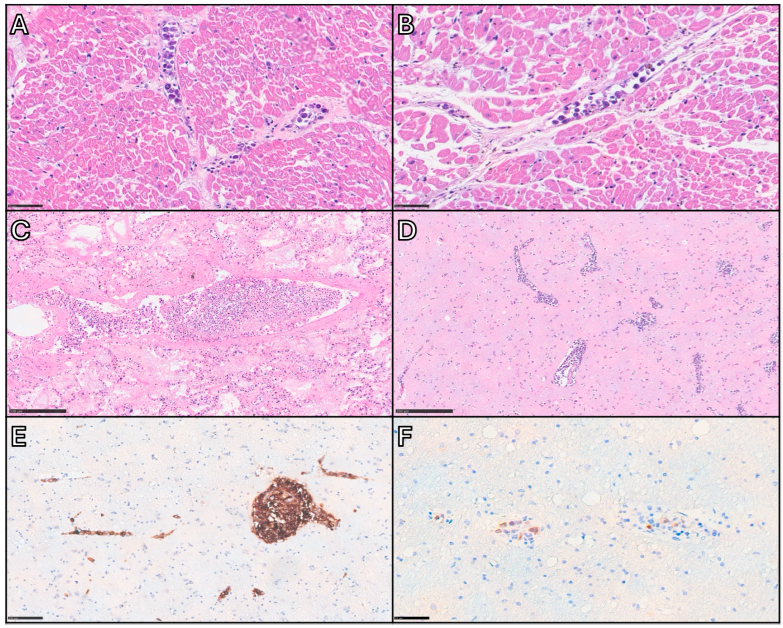 Cancers 17 02355 g003