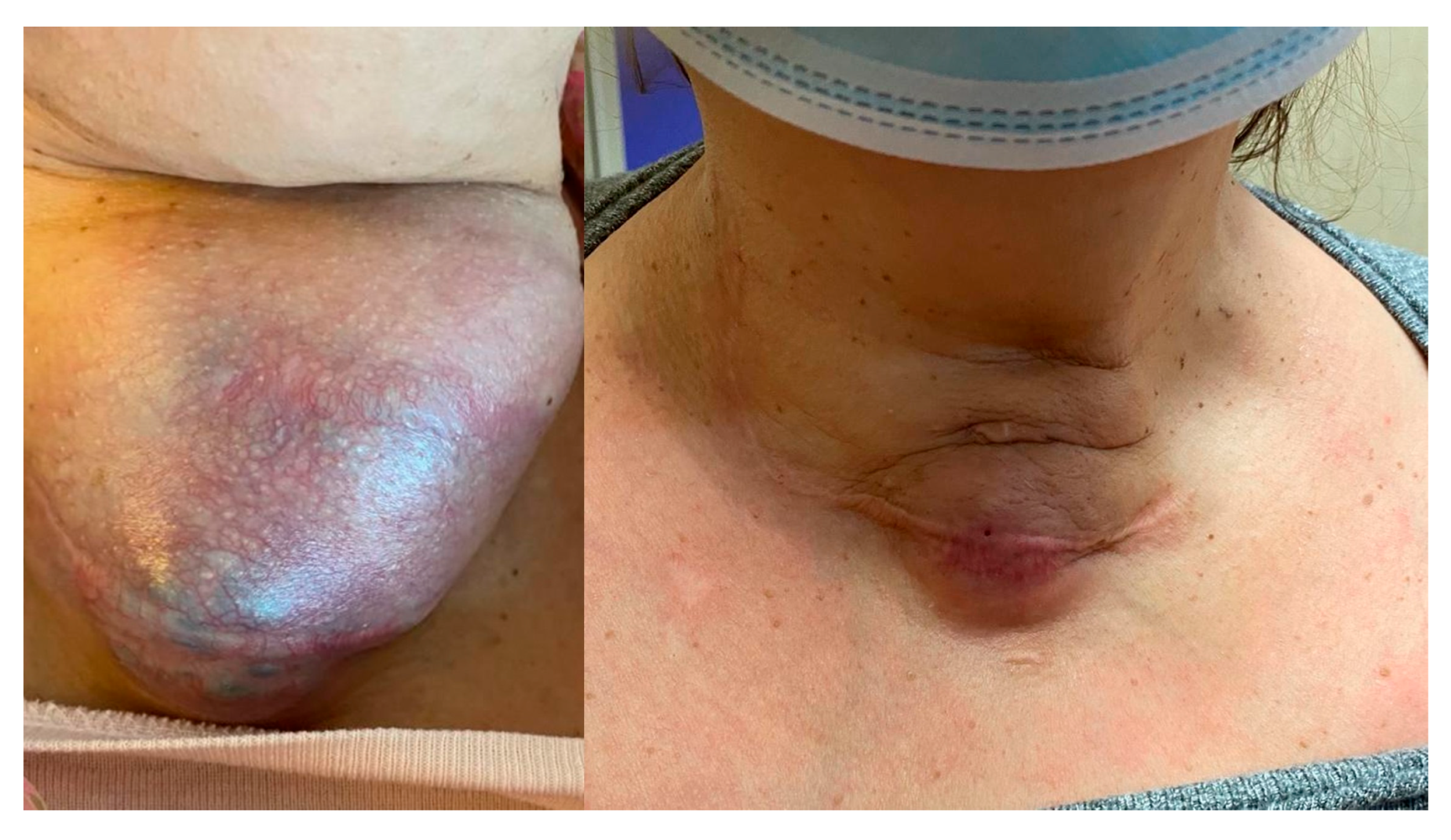 Cancers 17 02372 g002 Cancers 17 02372 g002