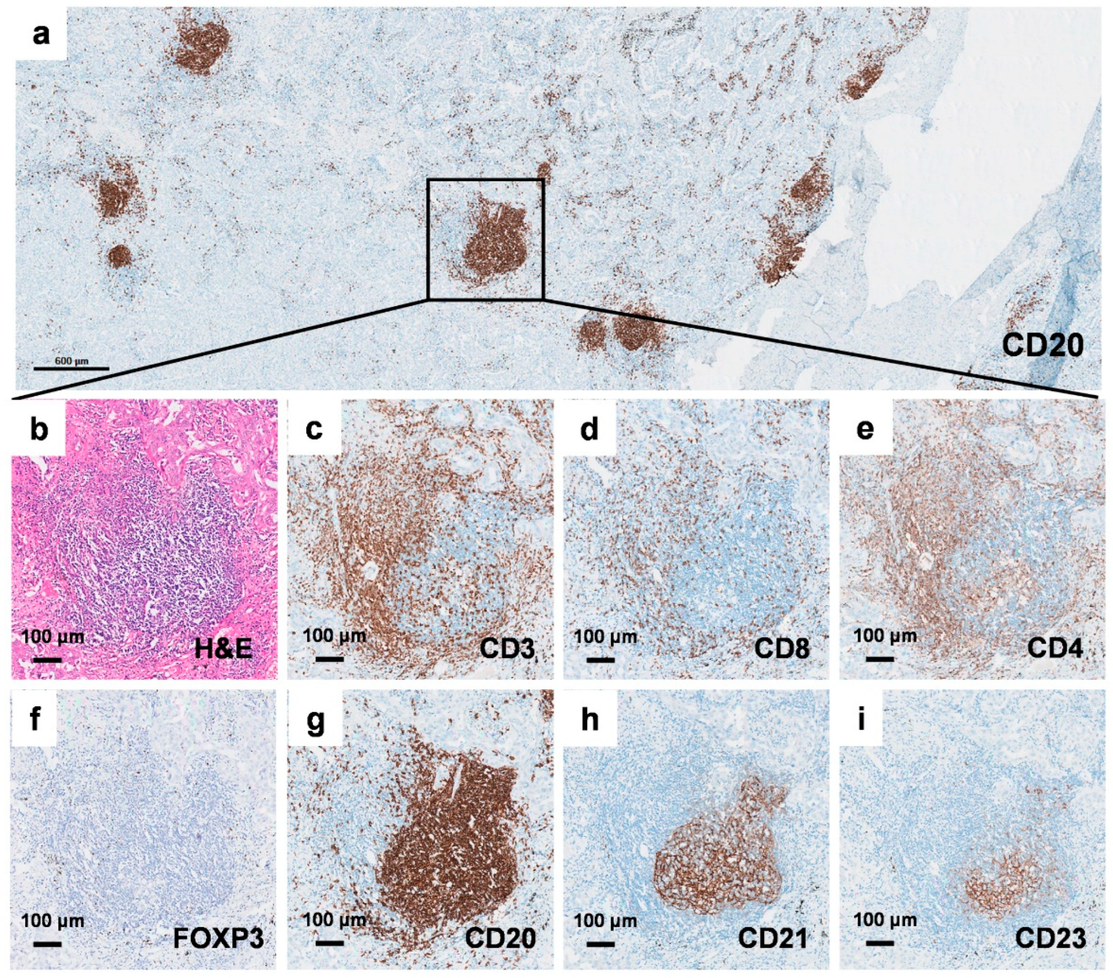 Cancers 17 02379 g001
