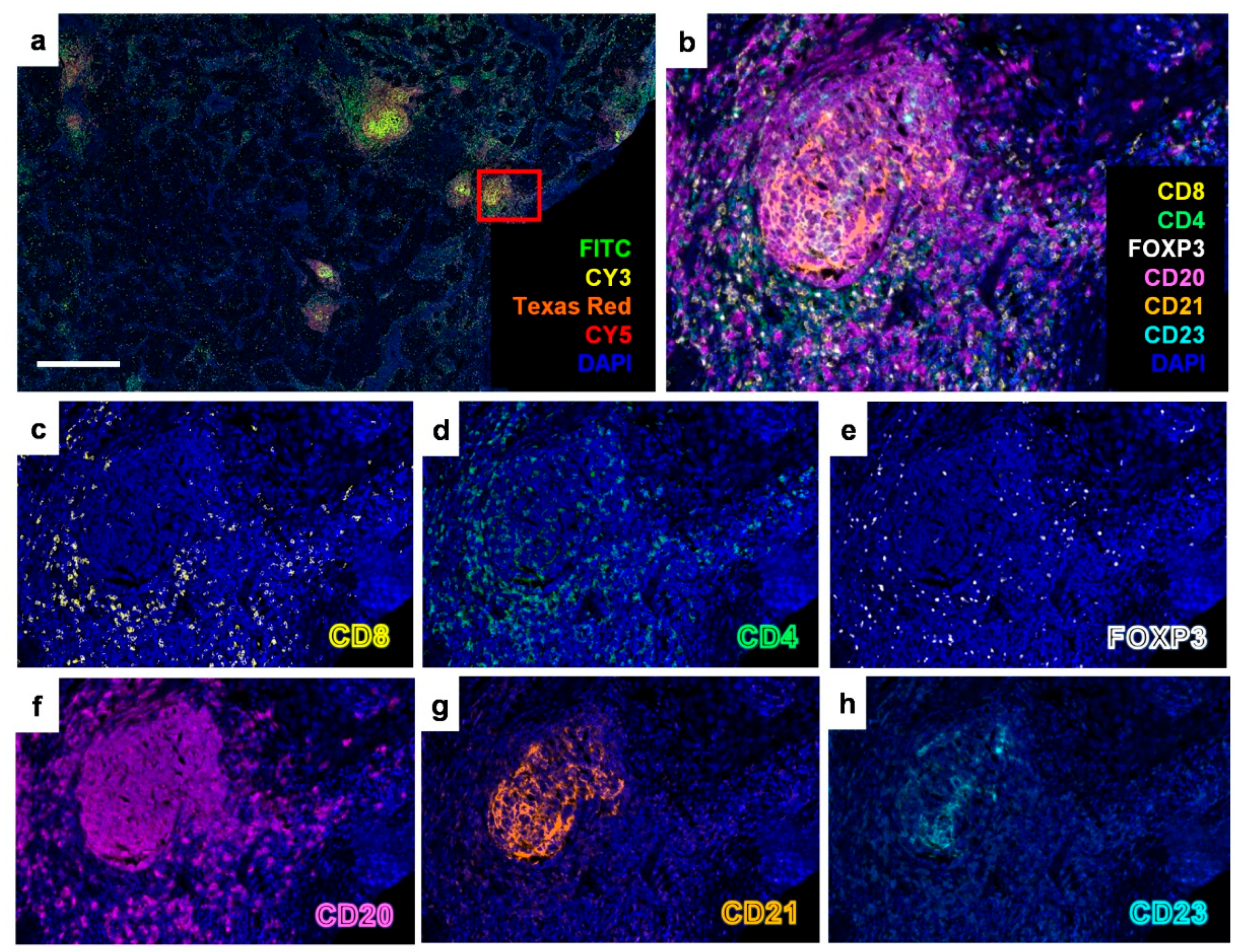 Cancers 17 02379 g002