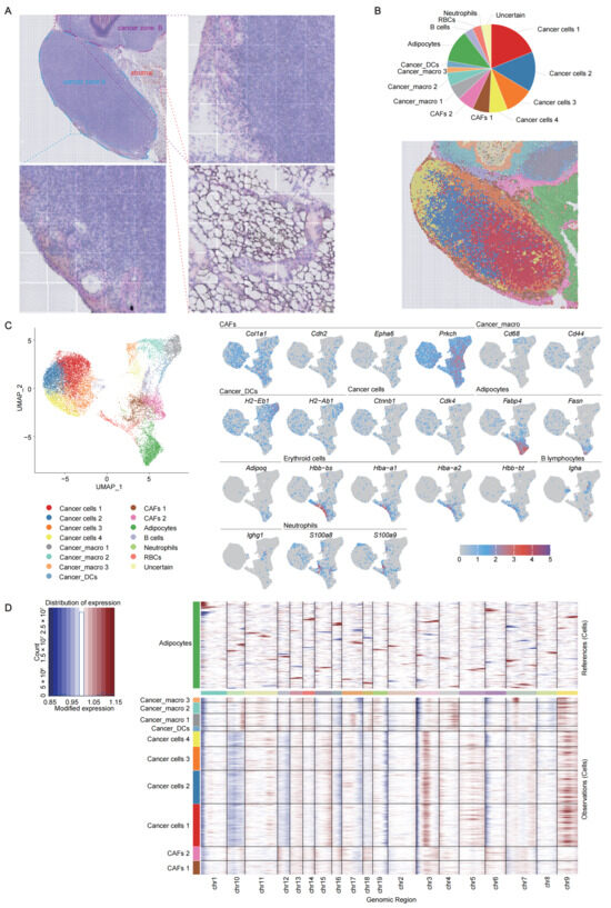 Cancer-Associated Fibroblasts Establish Spatially Distinct