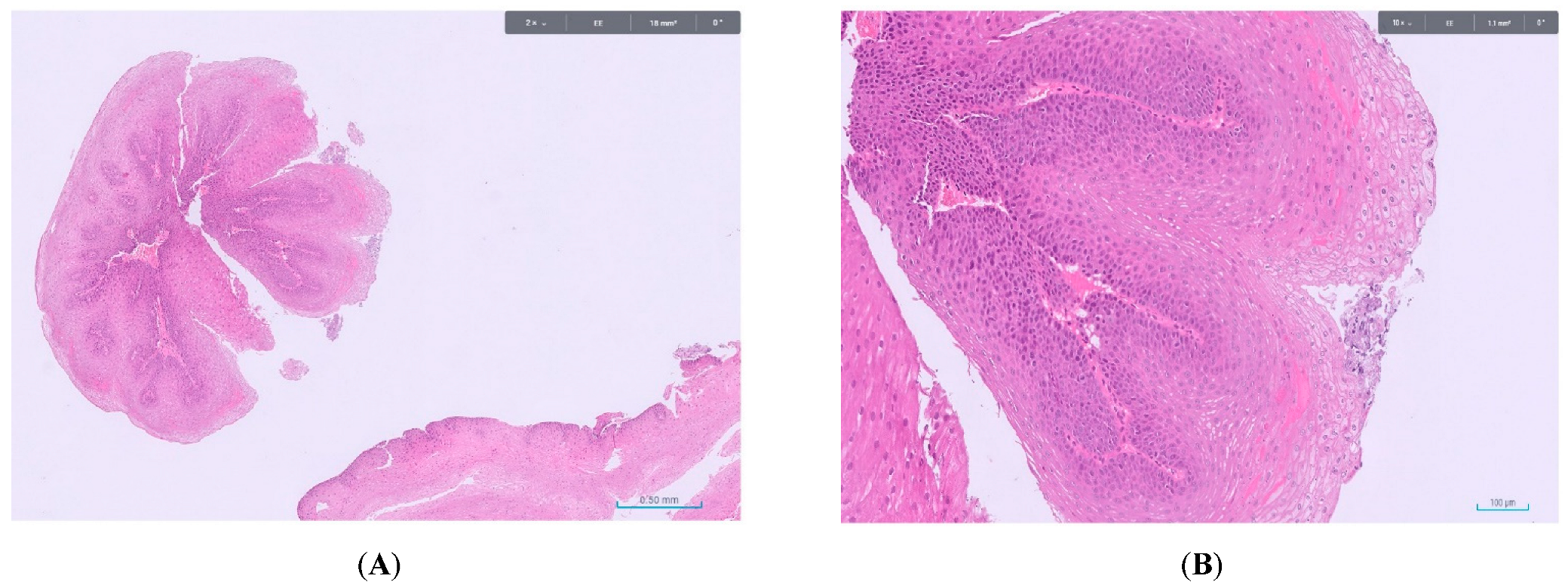 Cancers 17 02404 g002 Cancers 17 02404 g002