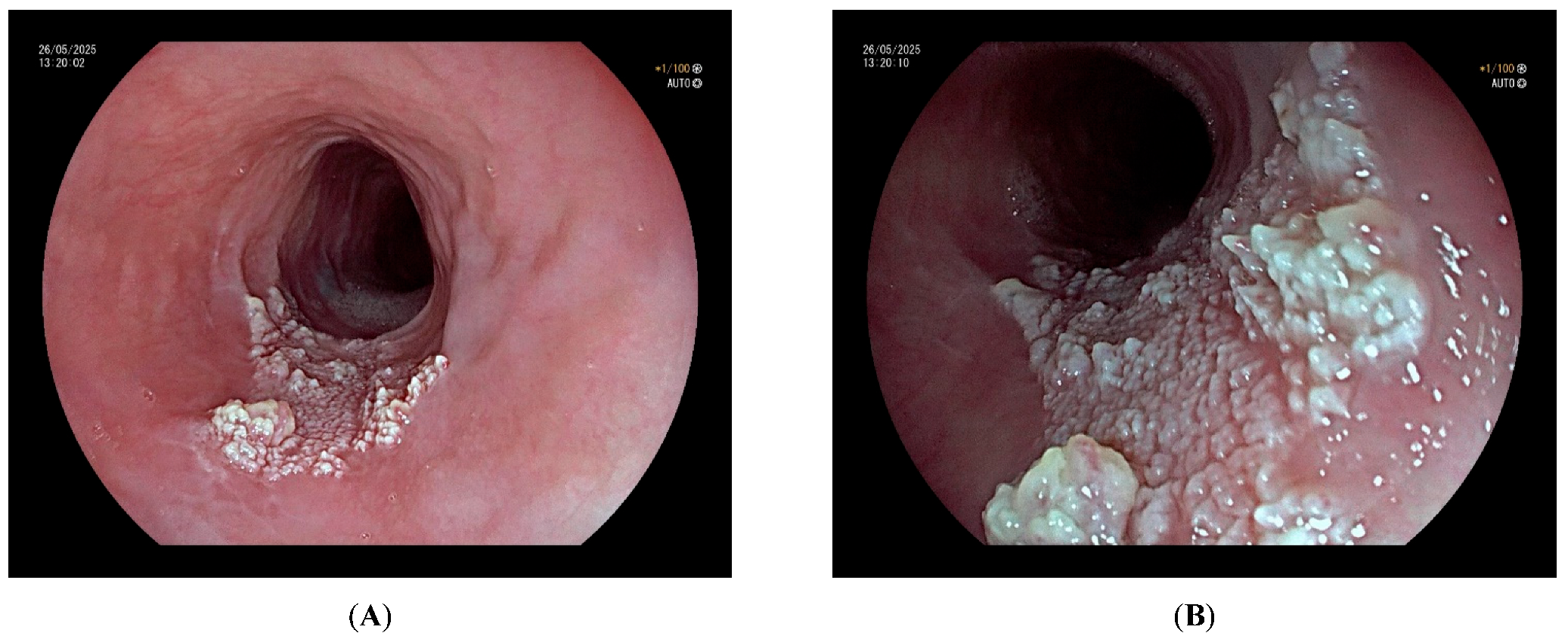 Cancers 17 02404 g003 Cancers 17 02404 g003